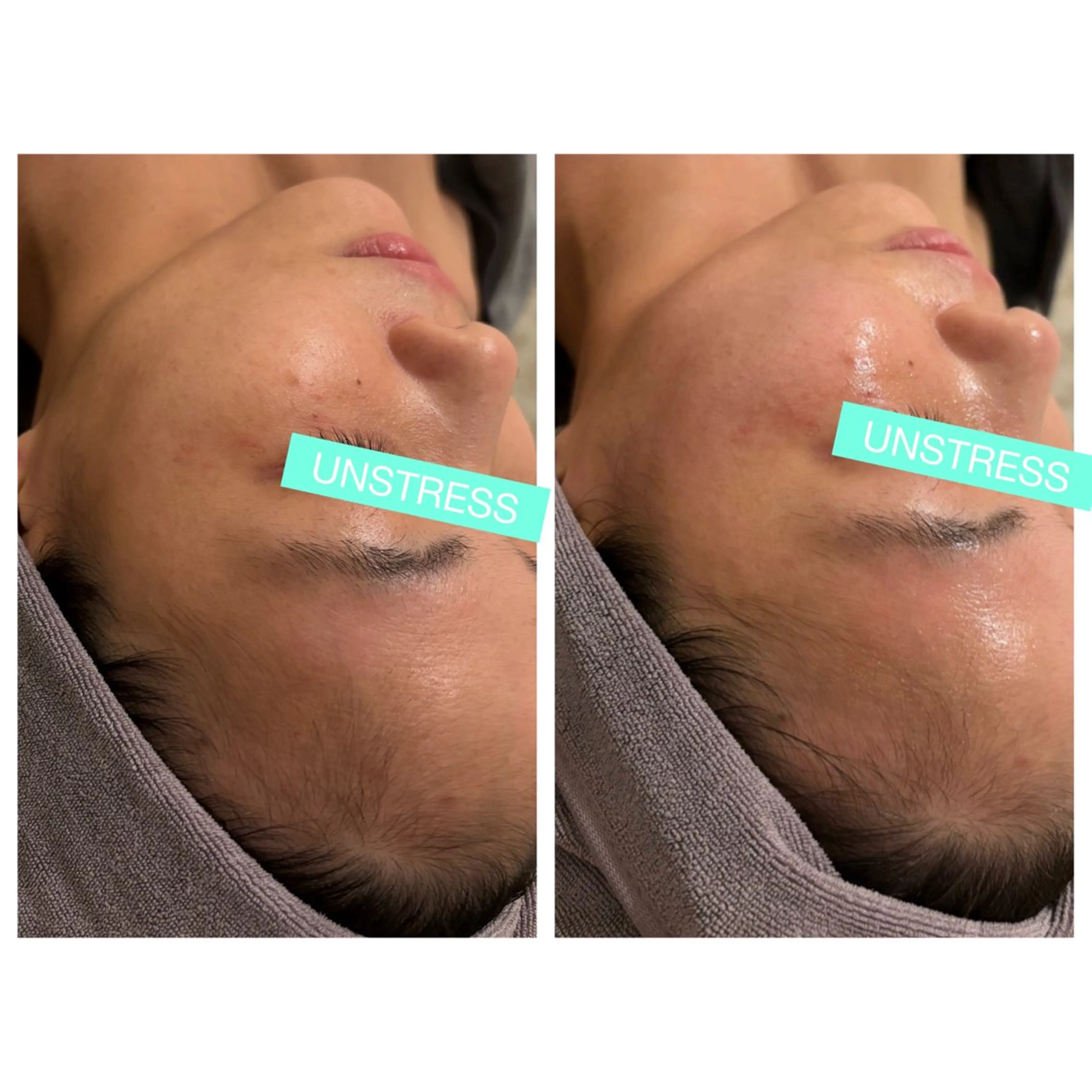 小顔コルギ ☆表参道/外苑前のエステ・リラクイメージ