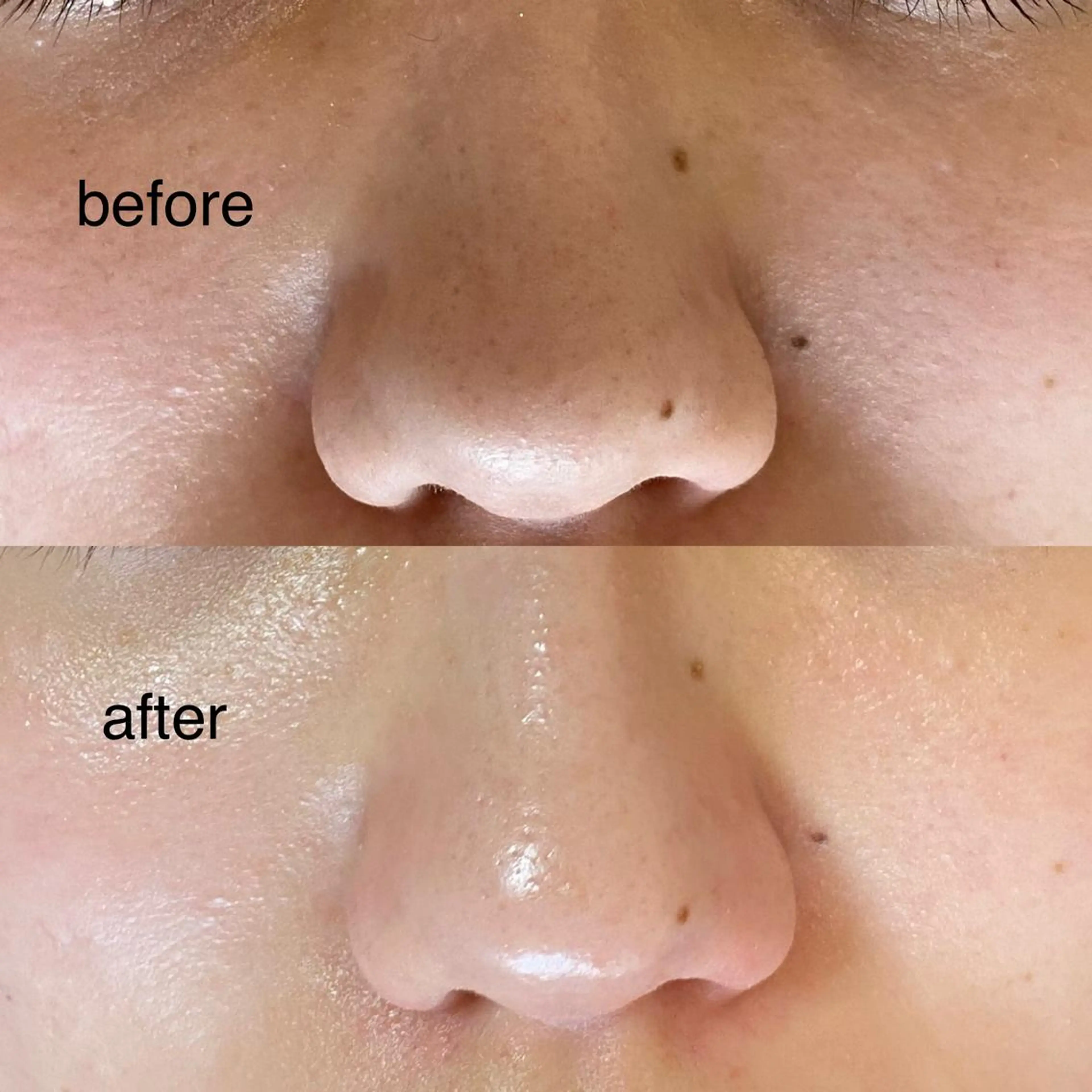 毛穴専門サロン フルール所属・フルールFululu 自由が丘のエステ・リラクイメージ