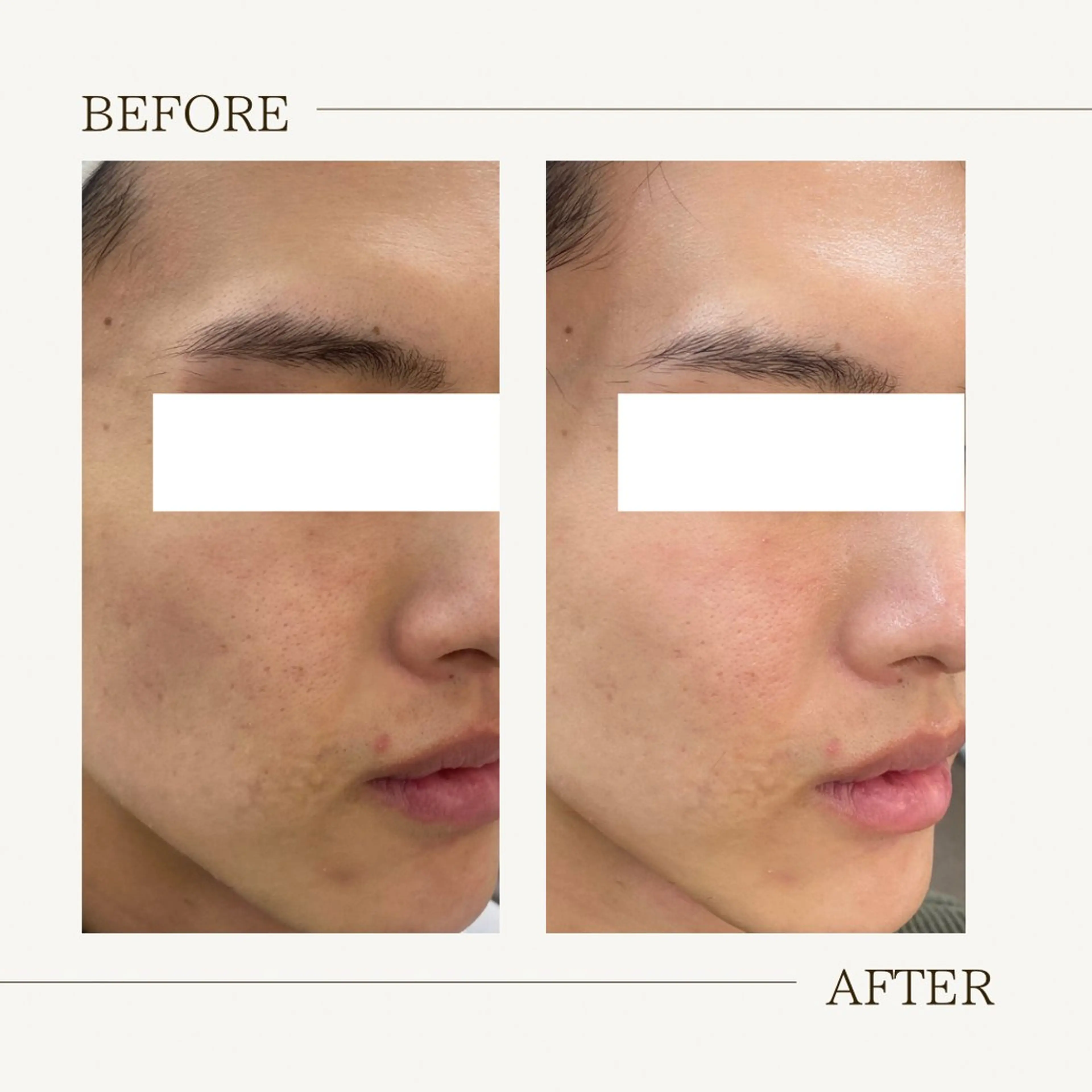 肌育成サロン ♡ RISAのエステ・リラクイメージ