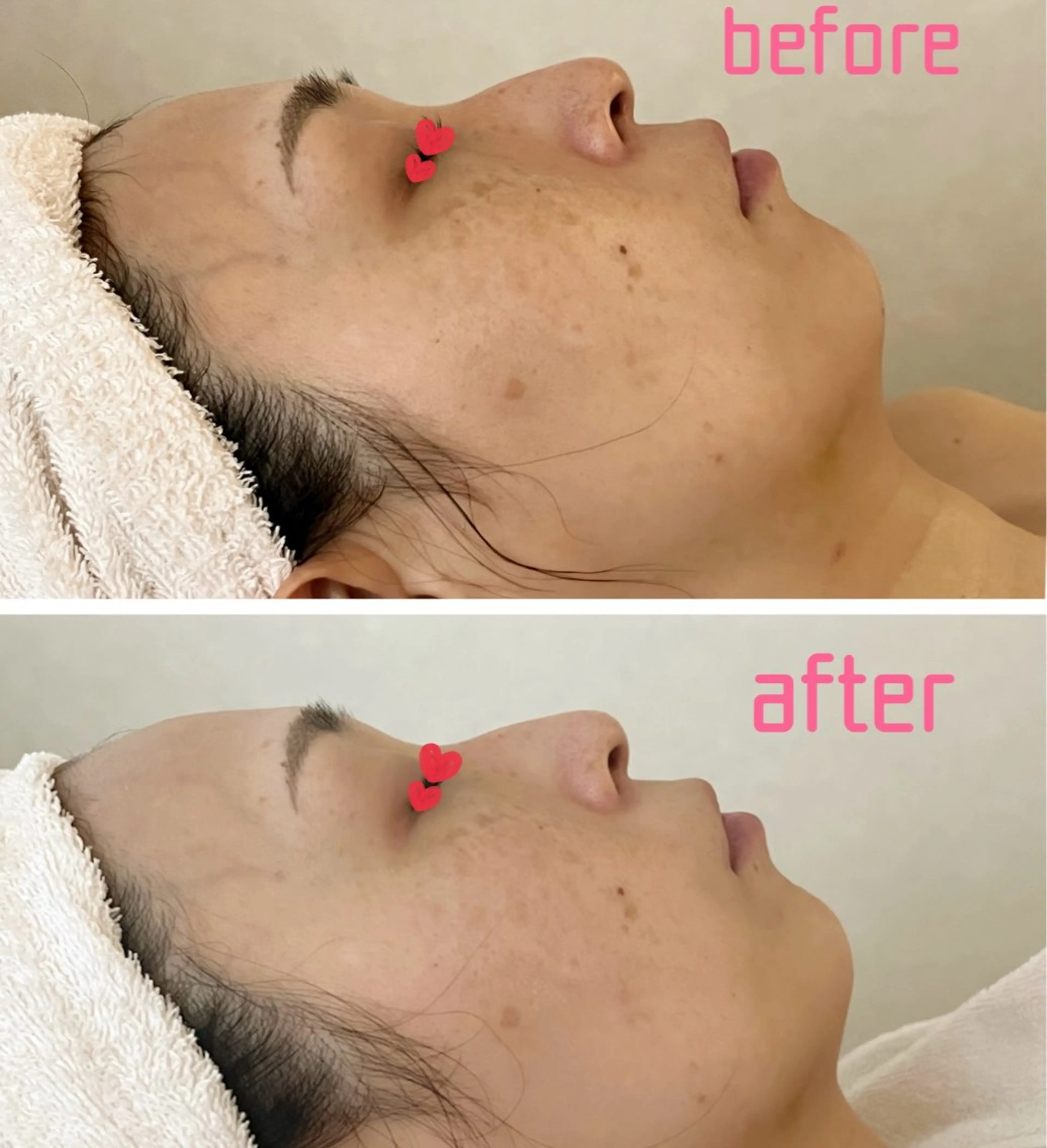 エステ Alluring アルーリング中村のエステ・リラクイメージ