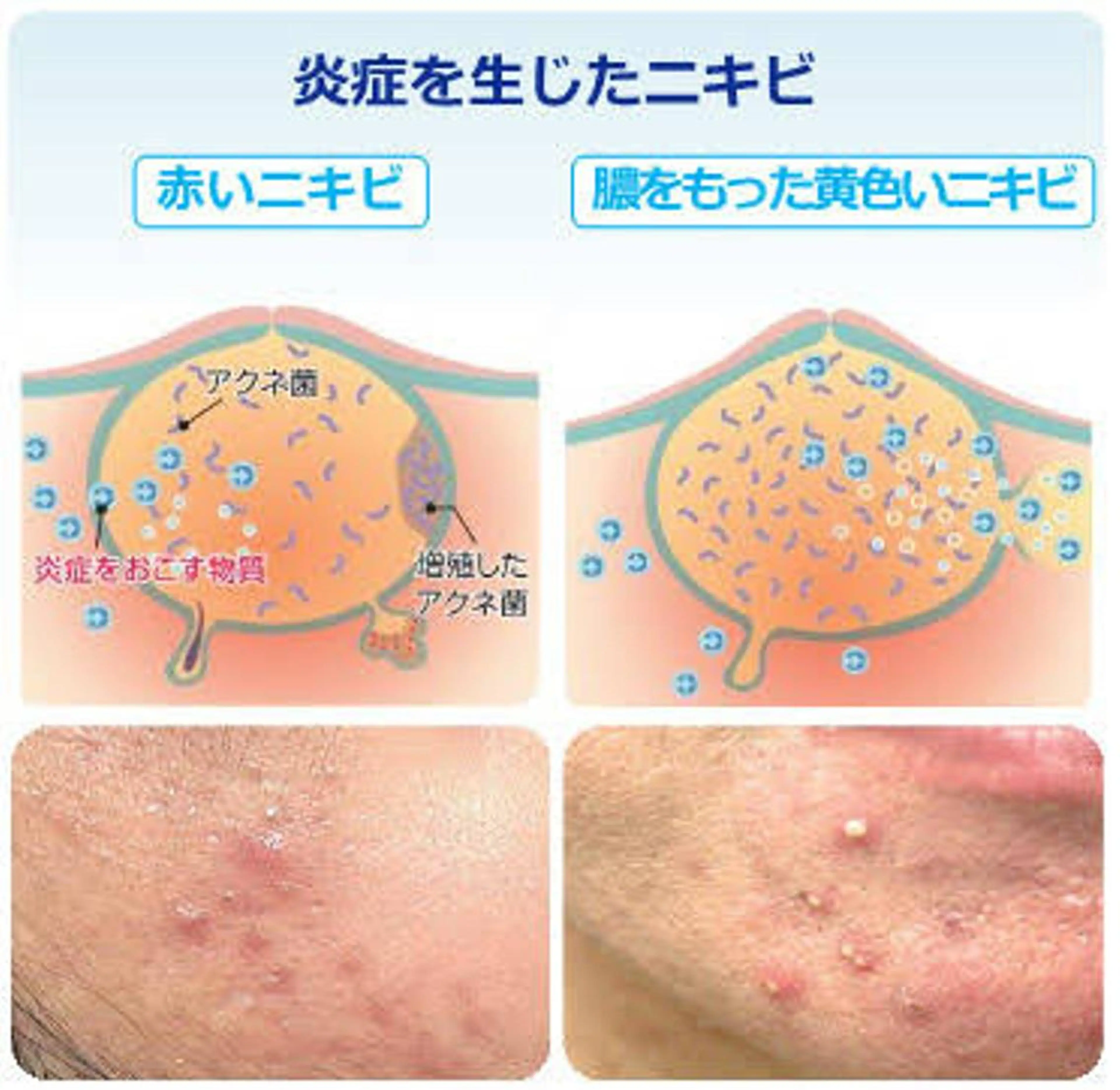 その他 フェイシャル専門 肌質改善/プランスのエステ・リラクイメージ