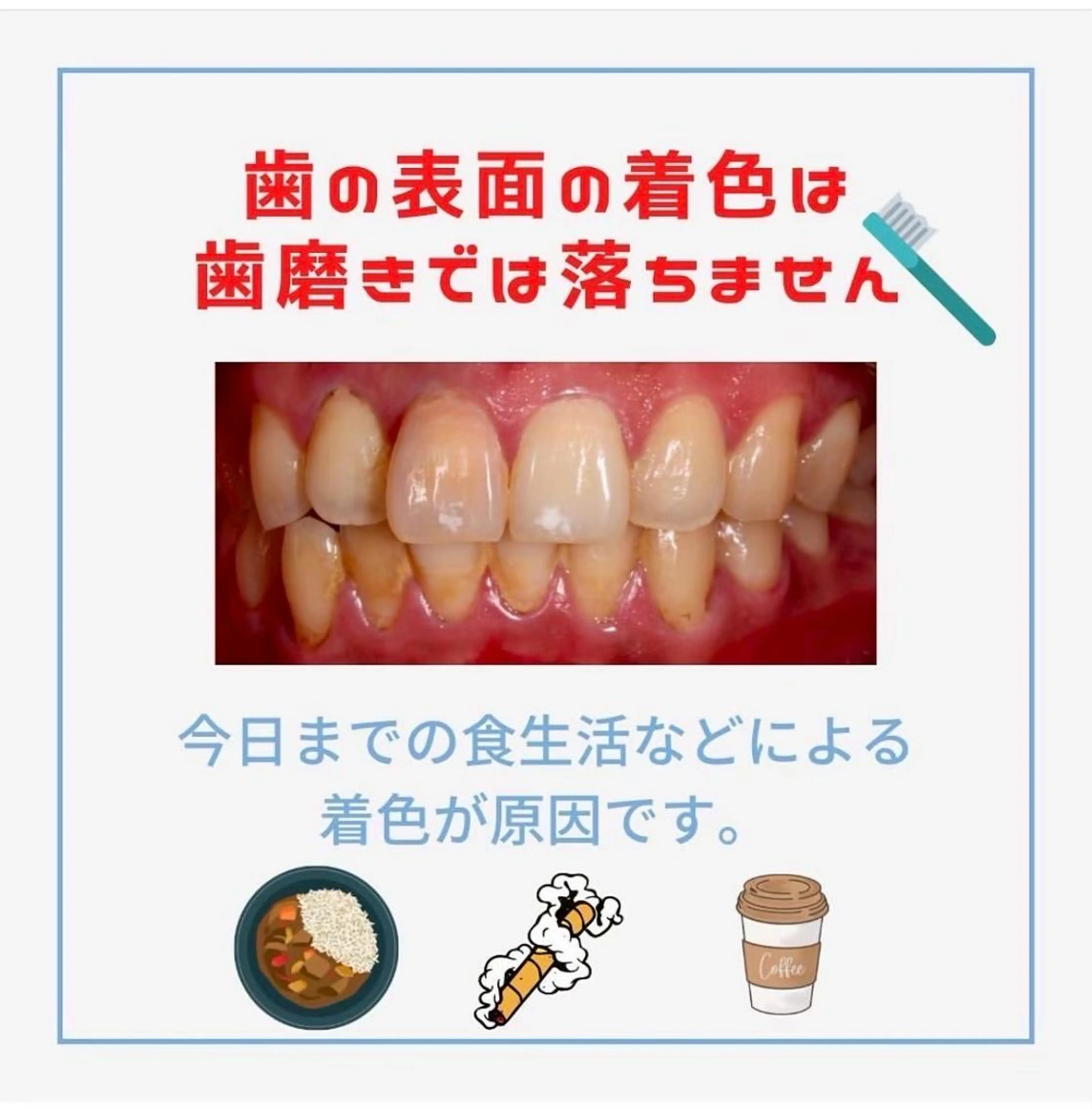 メンズ その他 ホワイトニング ショップ千葉店のその他イメージ