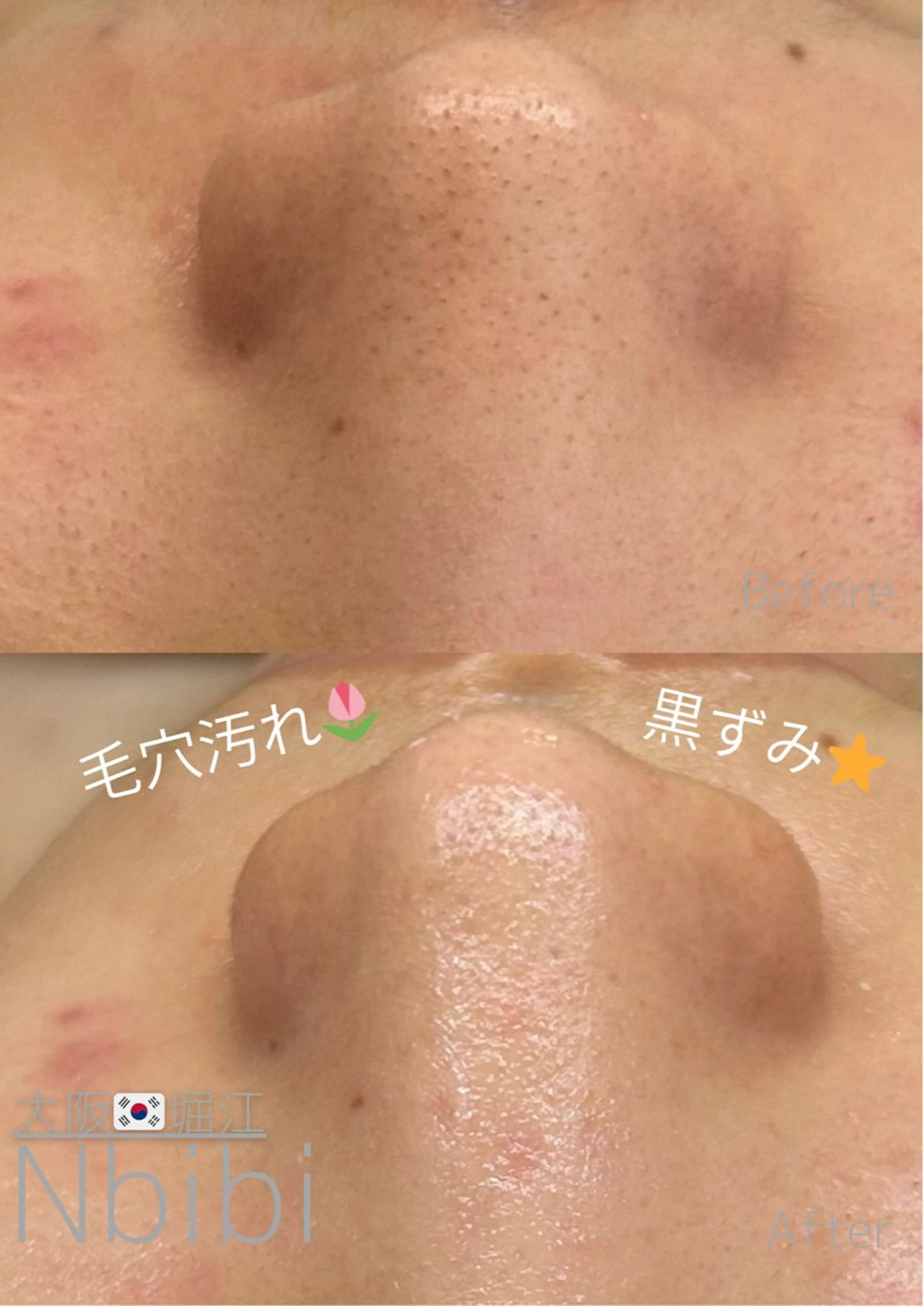 エステ 韓国🇰🇷価格 サロン_Nbibiの眉毛・アイブロウイメージ