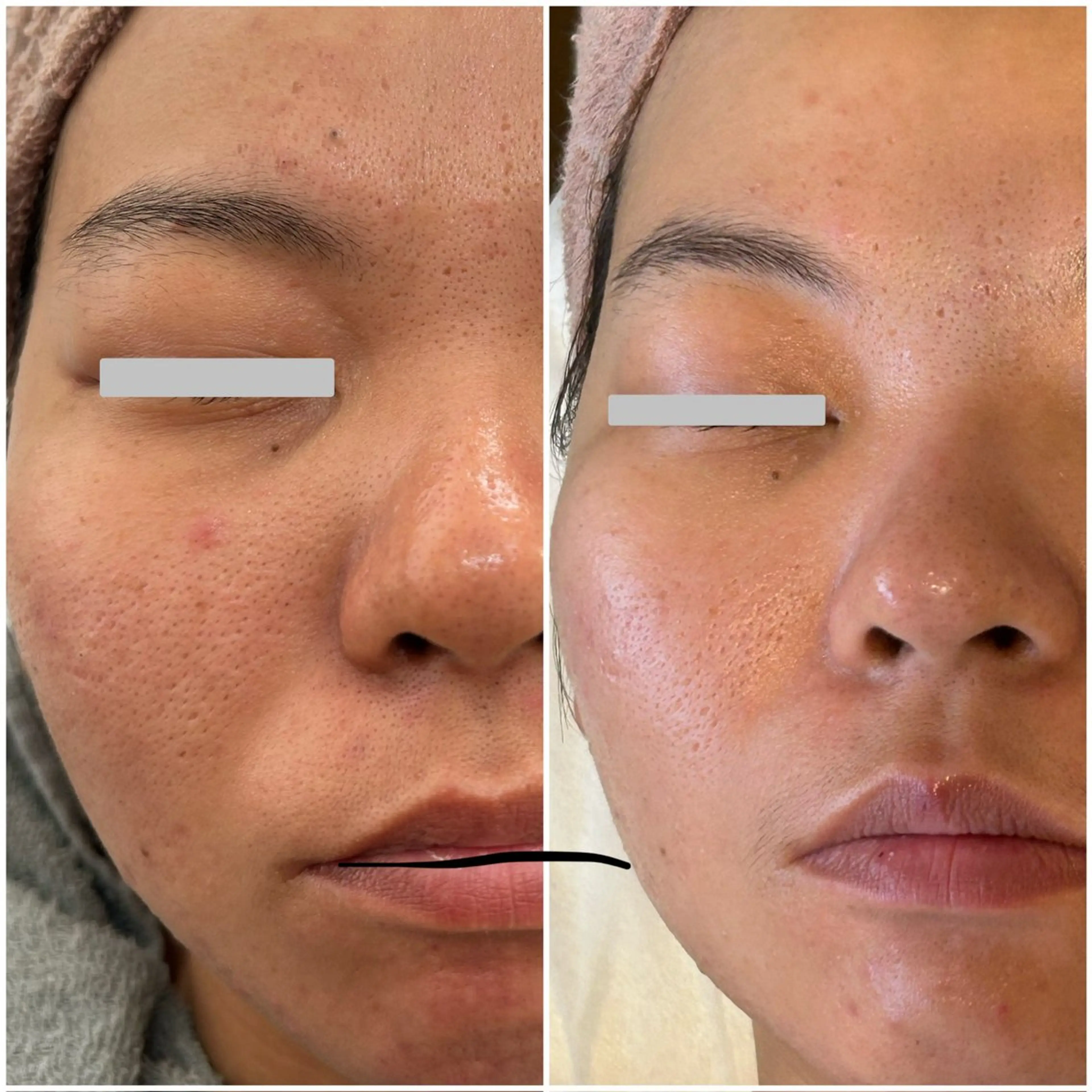 エステ プレジール所属・ビューティサロン プレジールOTAKEのエステ・リラクイメージ