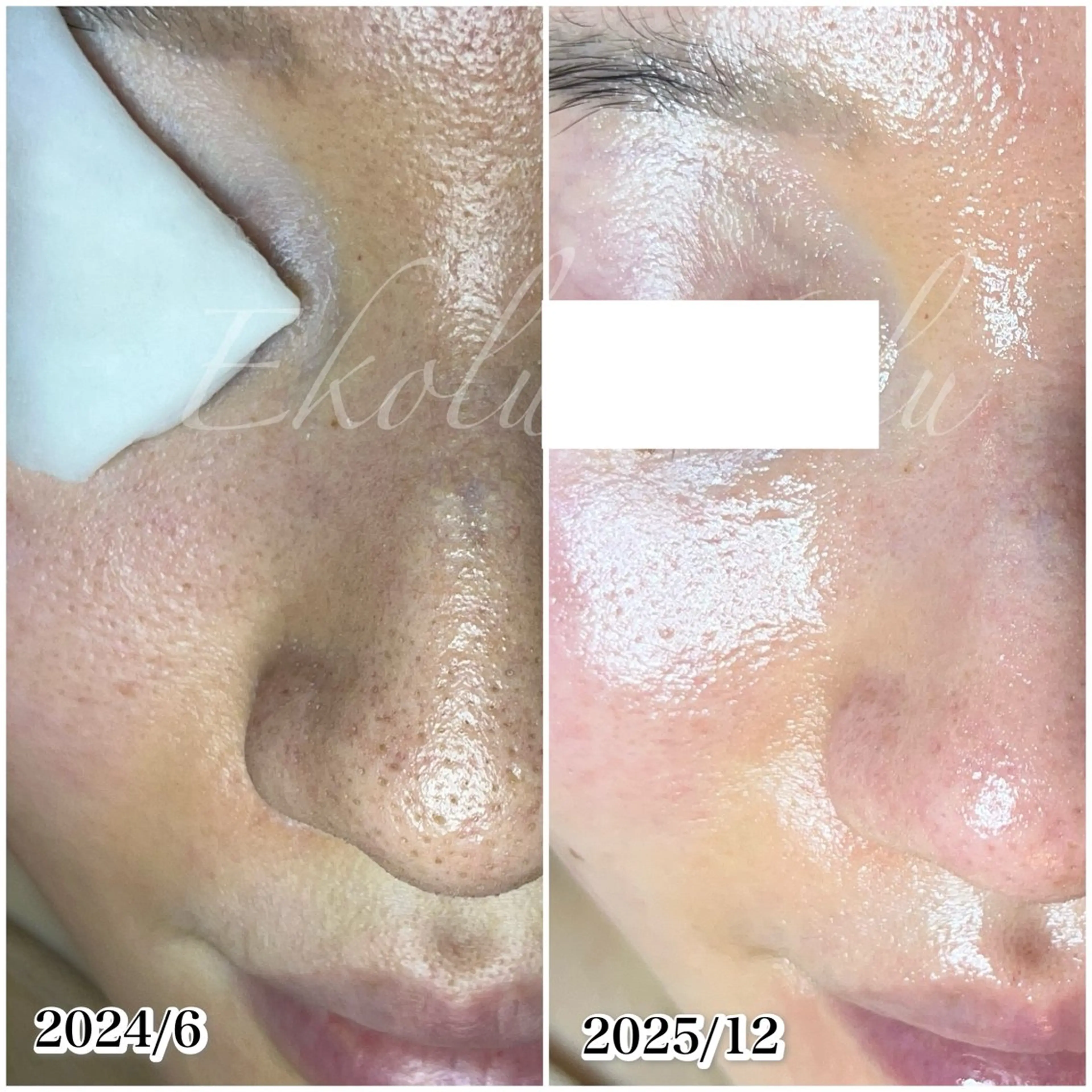 ツヤ肌・美肌サロン (エコル　フル)のエステ・リラクイメージ