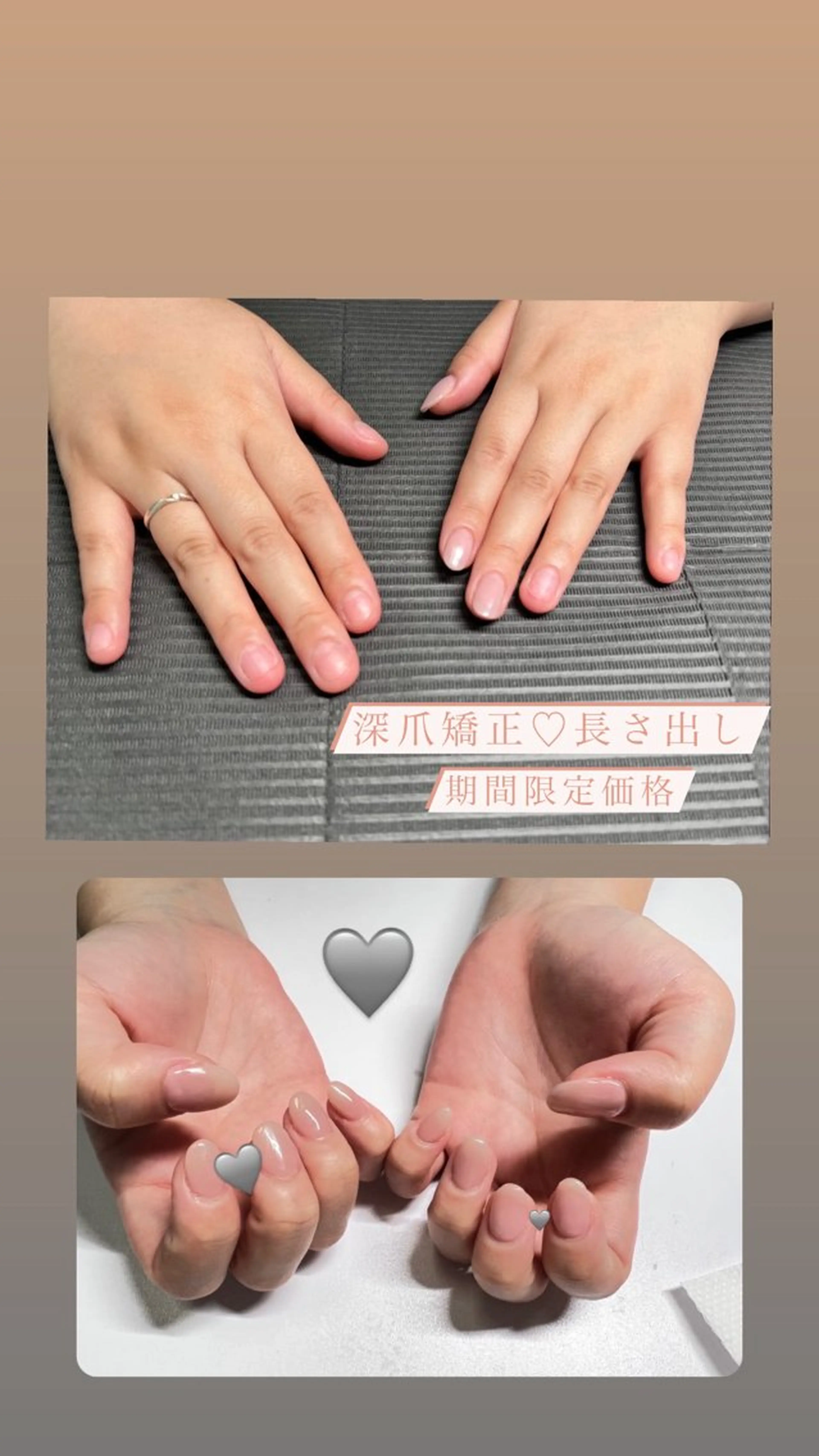 メンズ ネイル 爪ケア/深爪 自爪育成 🐰えむのネイルデザイン