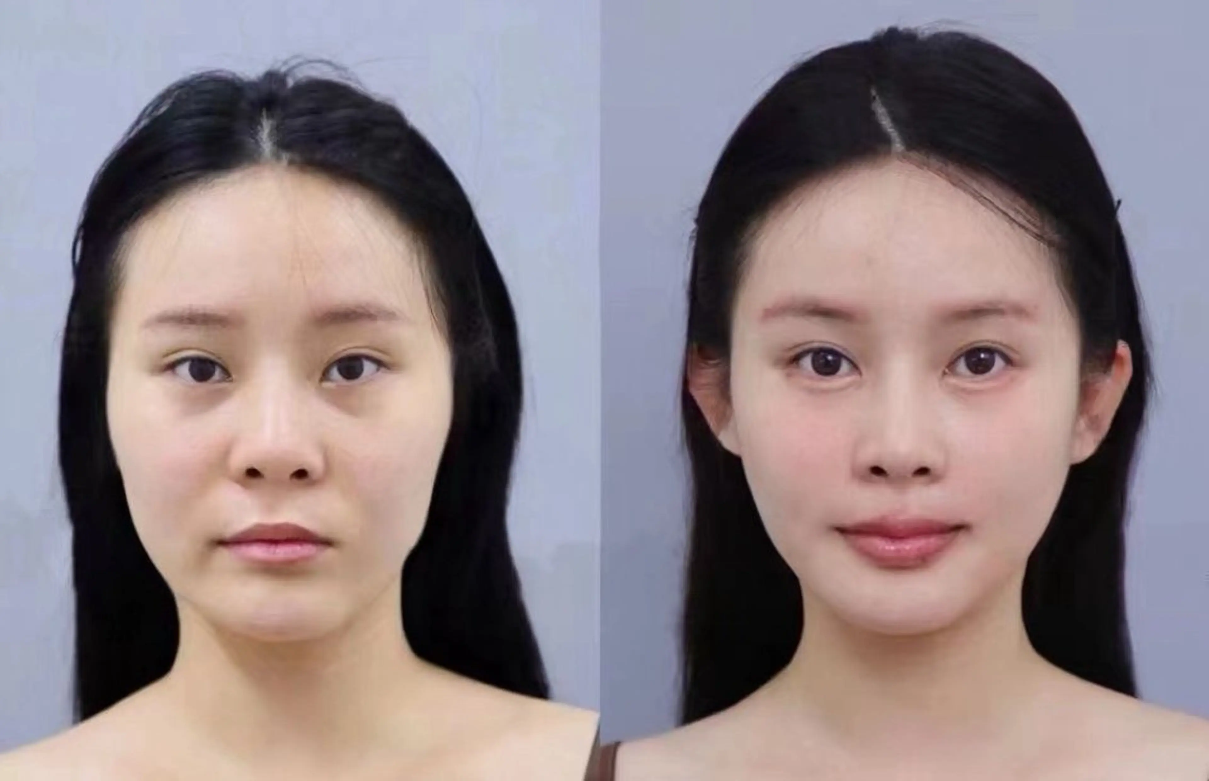 ショート エステ aliaハイフ&水光ジェットサロン所属・aliaハーブ水光店 エステティシャン募集のエステ・リラクイメージ