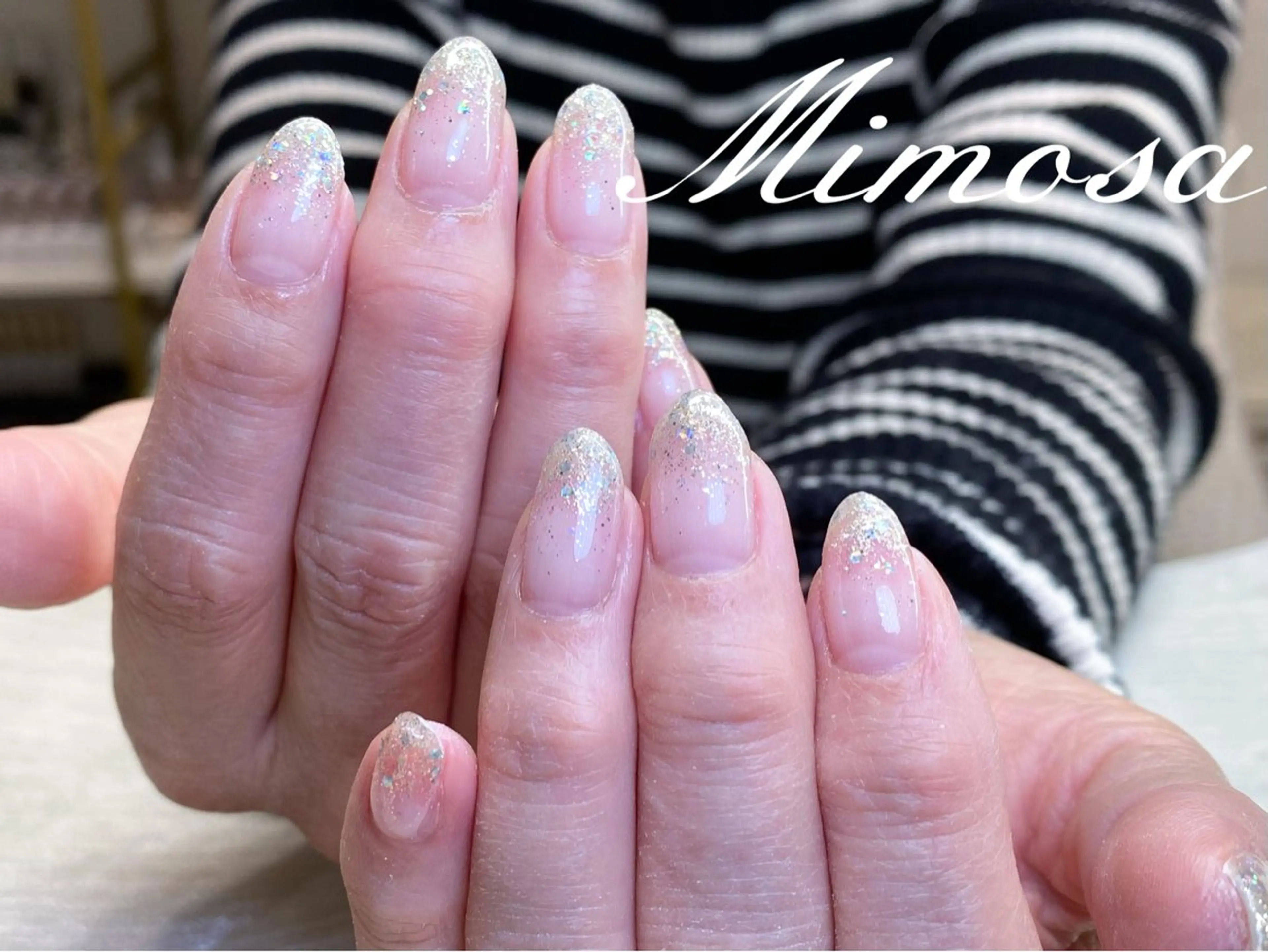 ネイル 💛Mimosa💛 吉祥寺のネイルデザイン