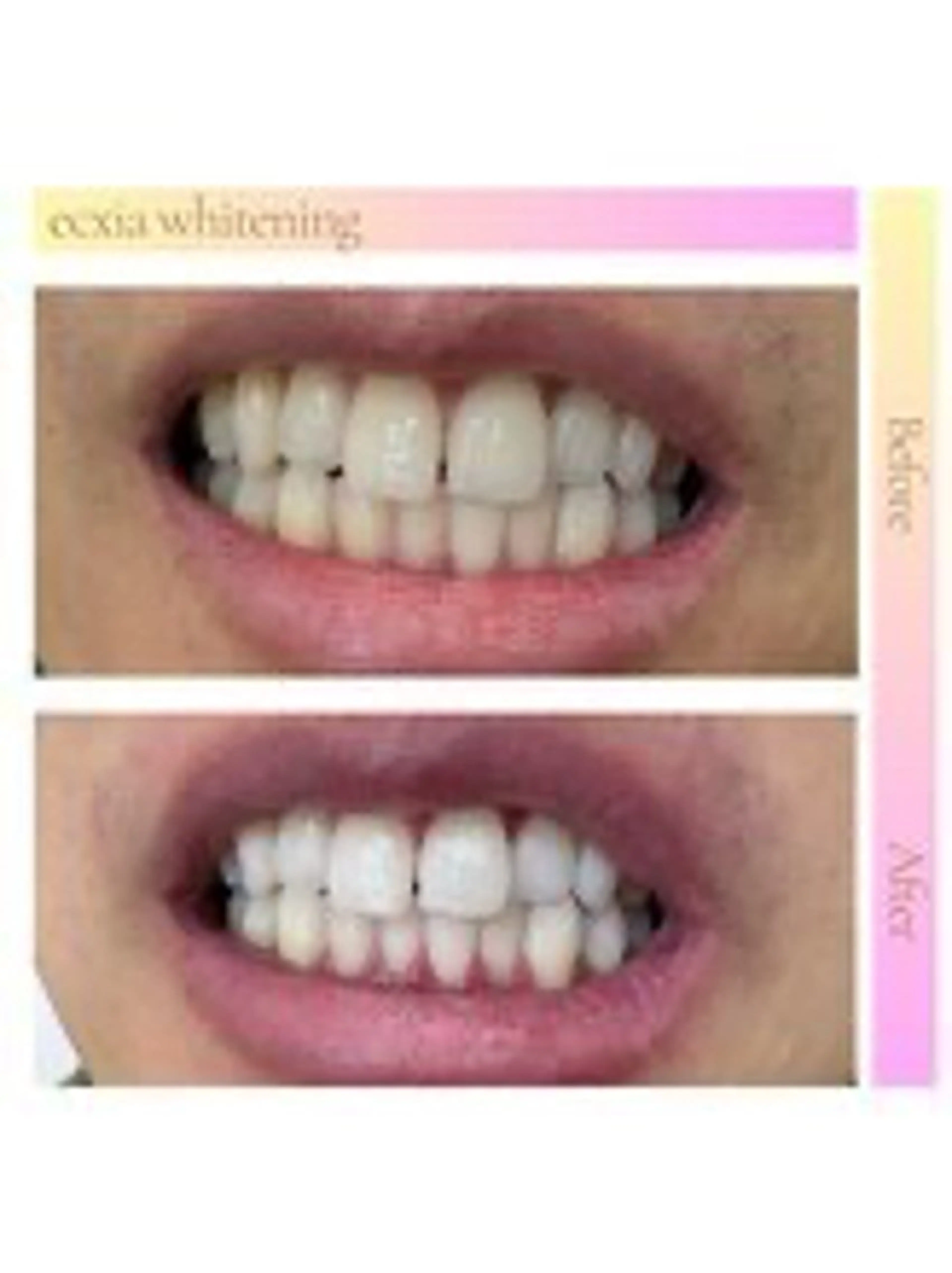 セルフホワイトニング エクシア西宮北口店のその他イメージ