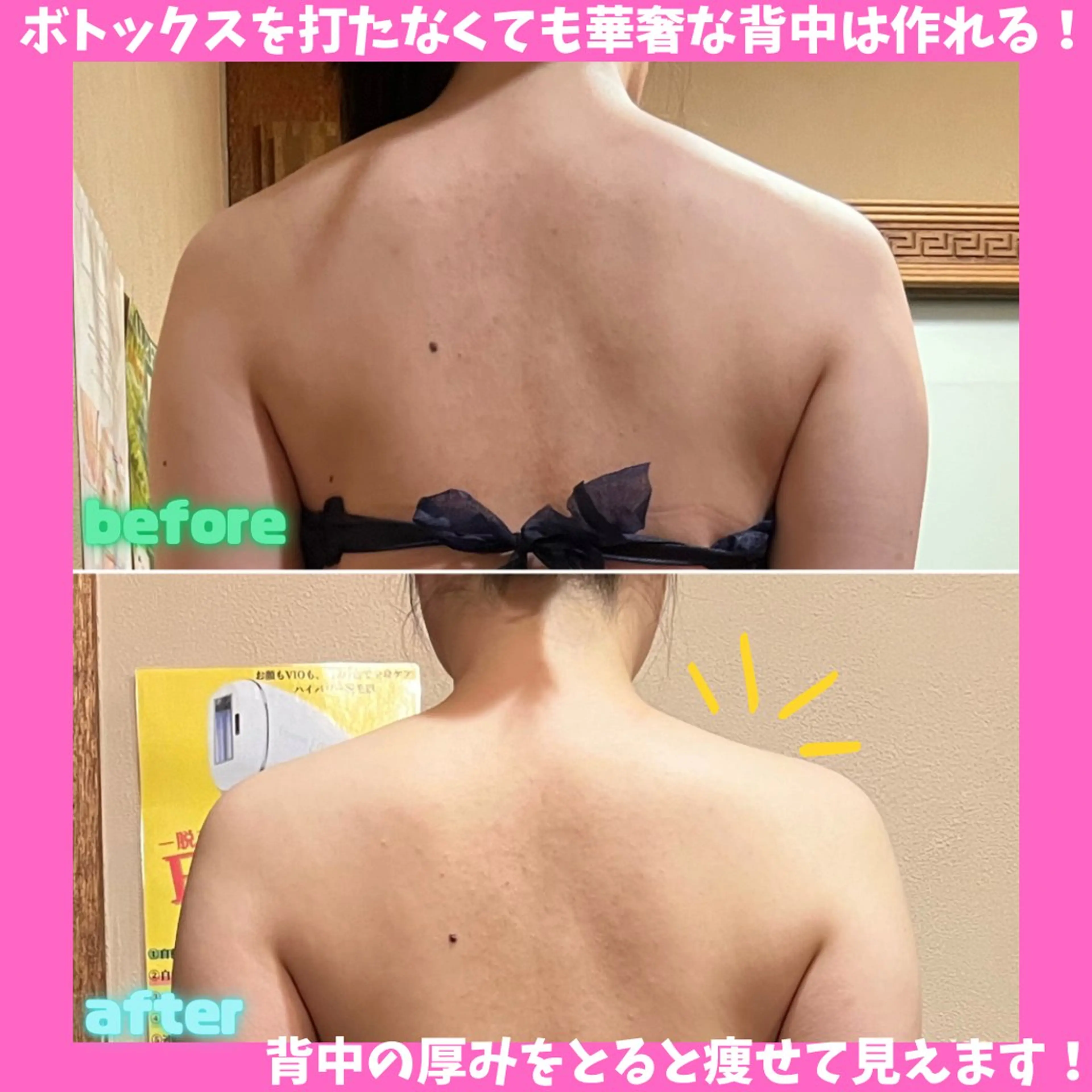 エステ リラク 痩身&美肌サロン 堀米✨のその他イメージ