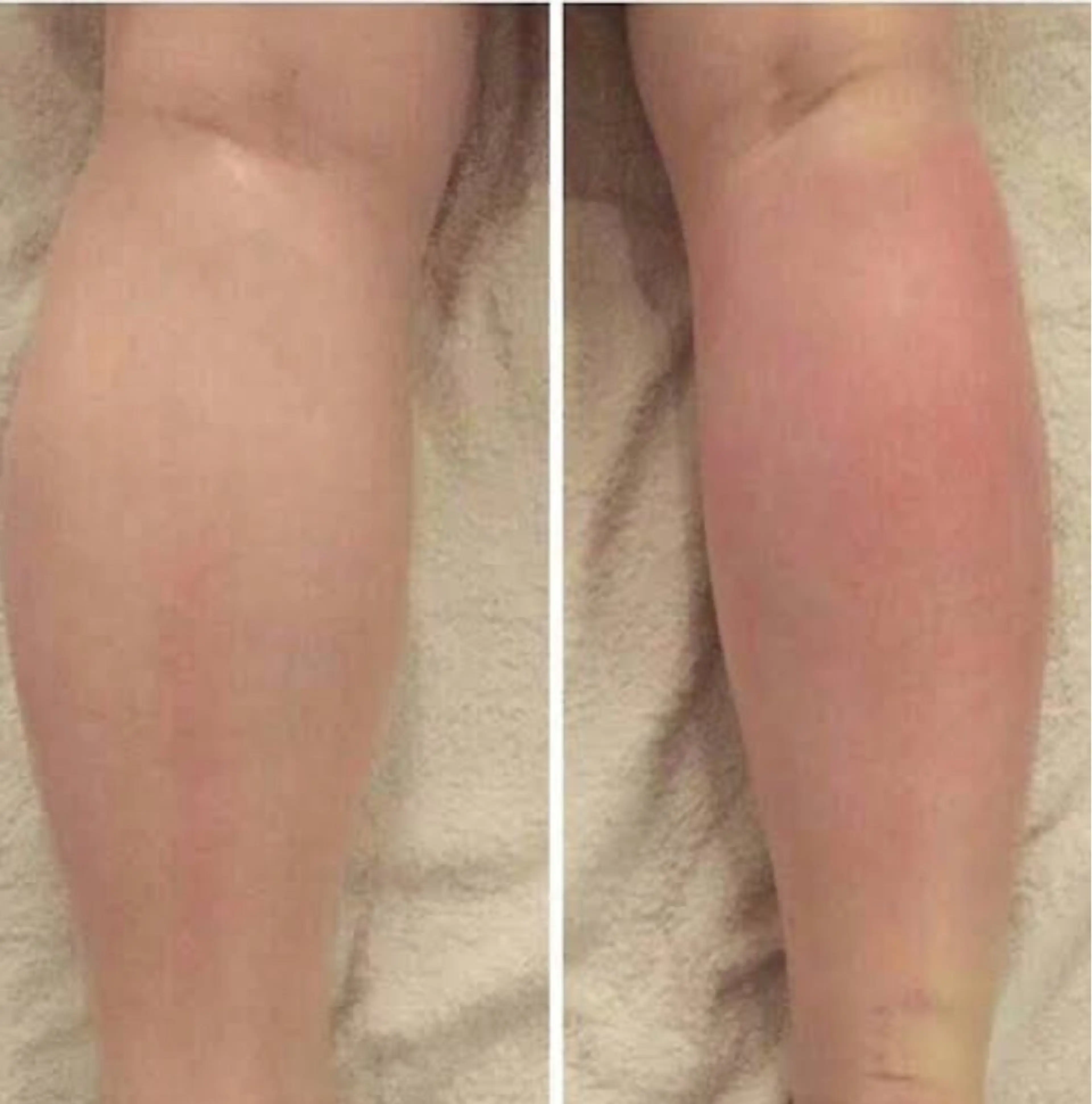 エステ リラク ☺ハーブピール💕 ソフィアカロン💖のエステ・リラクイメージ