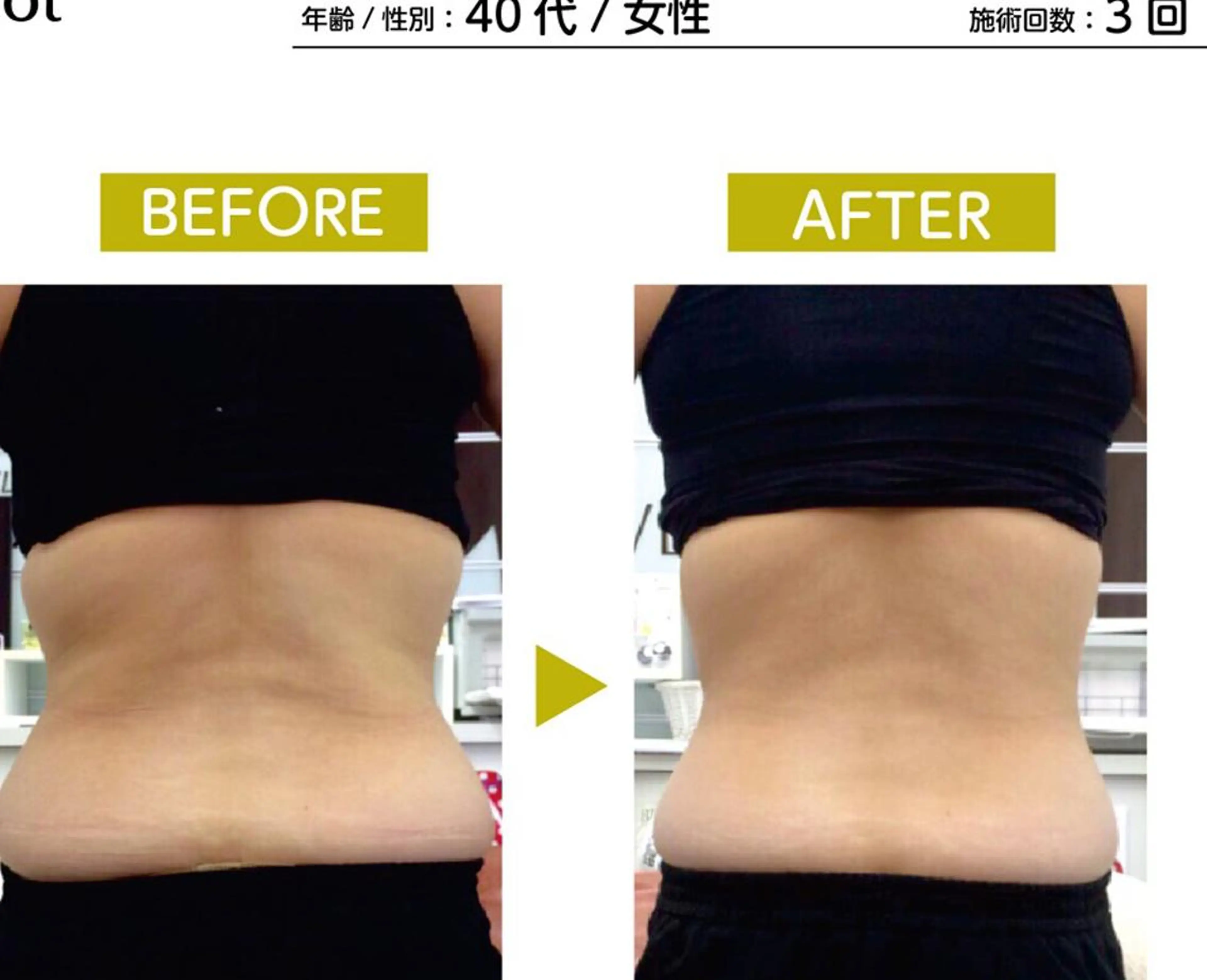 エステ リラク 🅖🅤🅩🅔🅛 salonのエステ・リラクイメージ