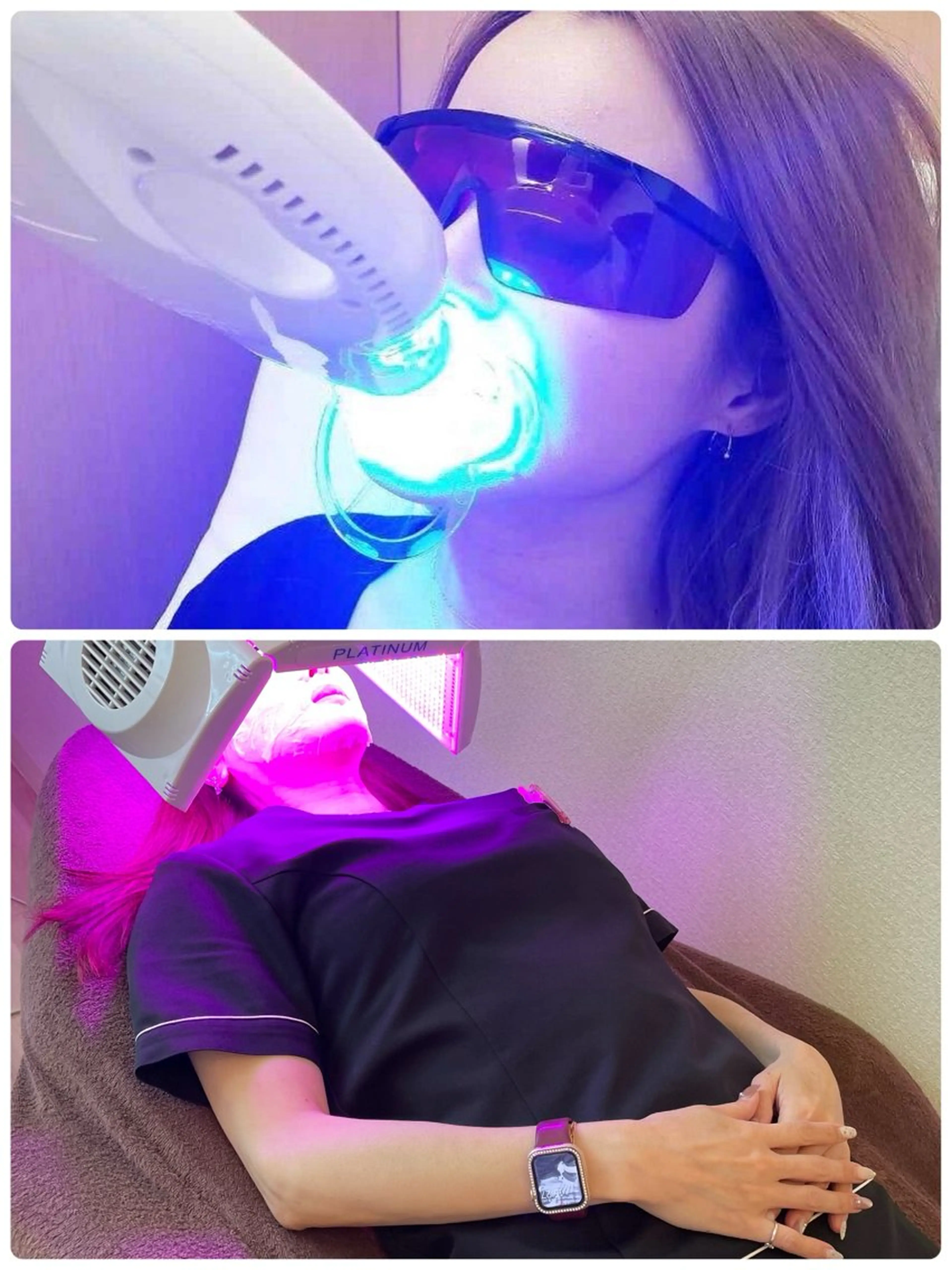 ホワイトニング「10分×2」➕LEDフェイシャル「30分」スペシャルパック🤗歯もお肌もより素敵に💕🌹の写真