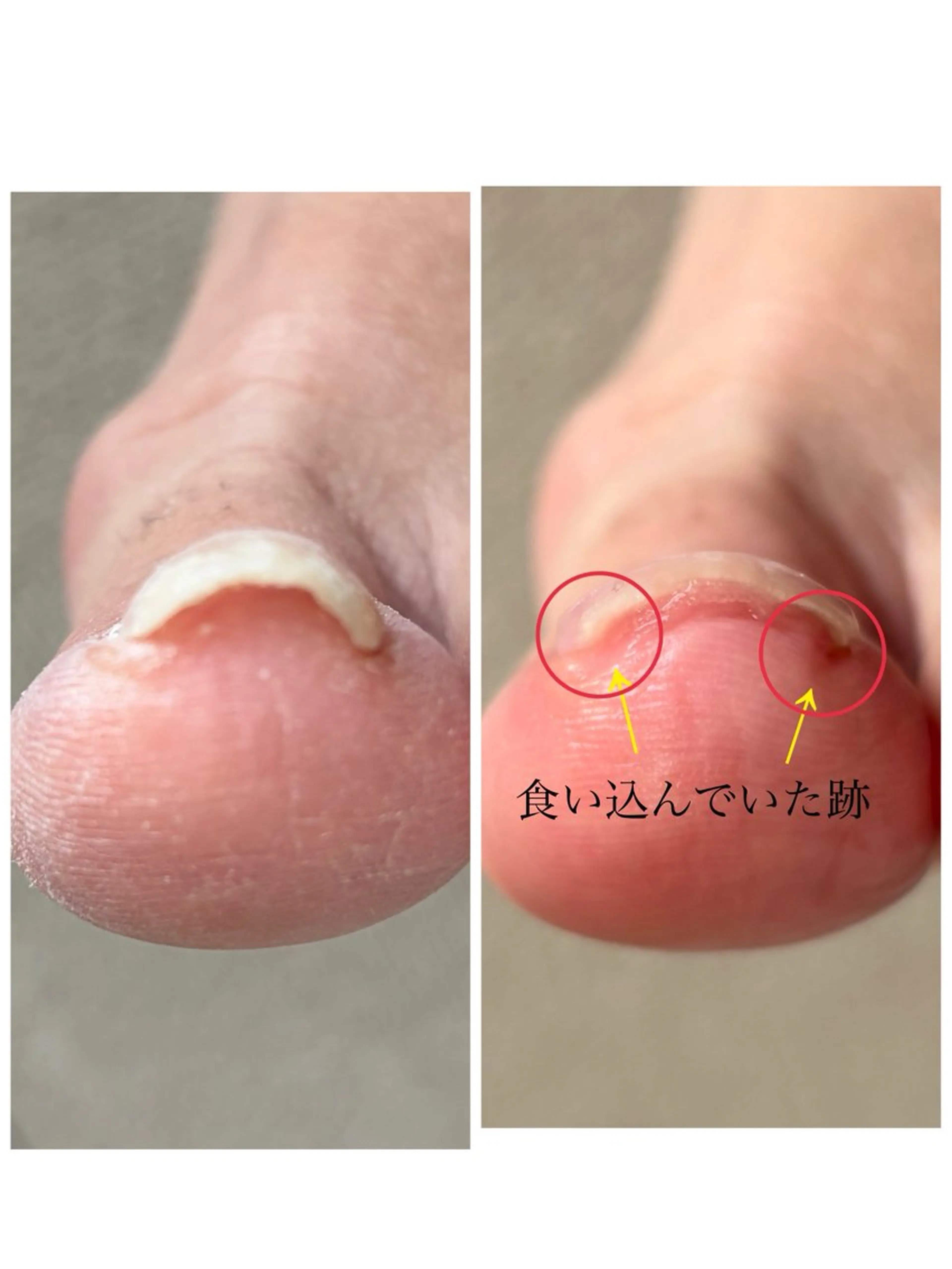 メンズ ネイル Chérinail 爪のお手入れのネイルデザイン