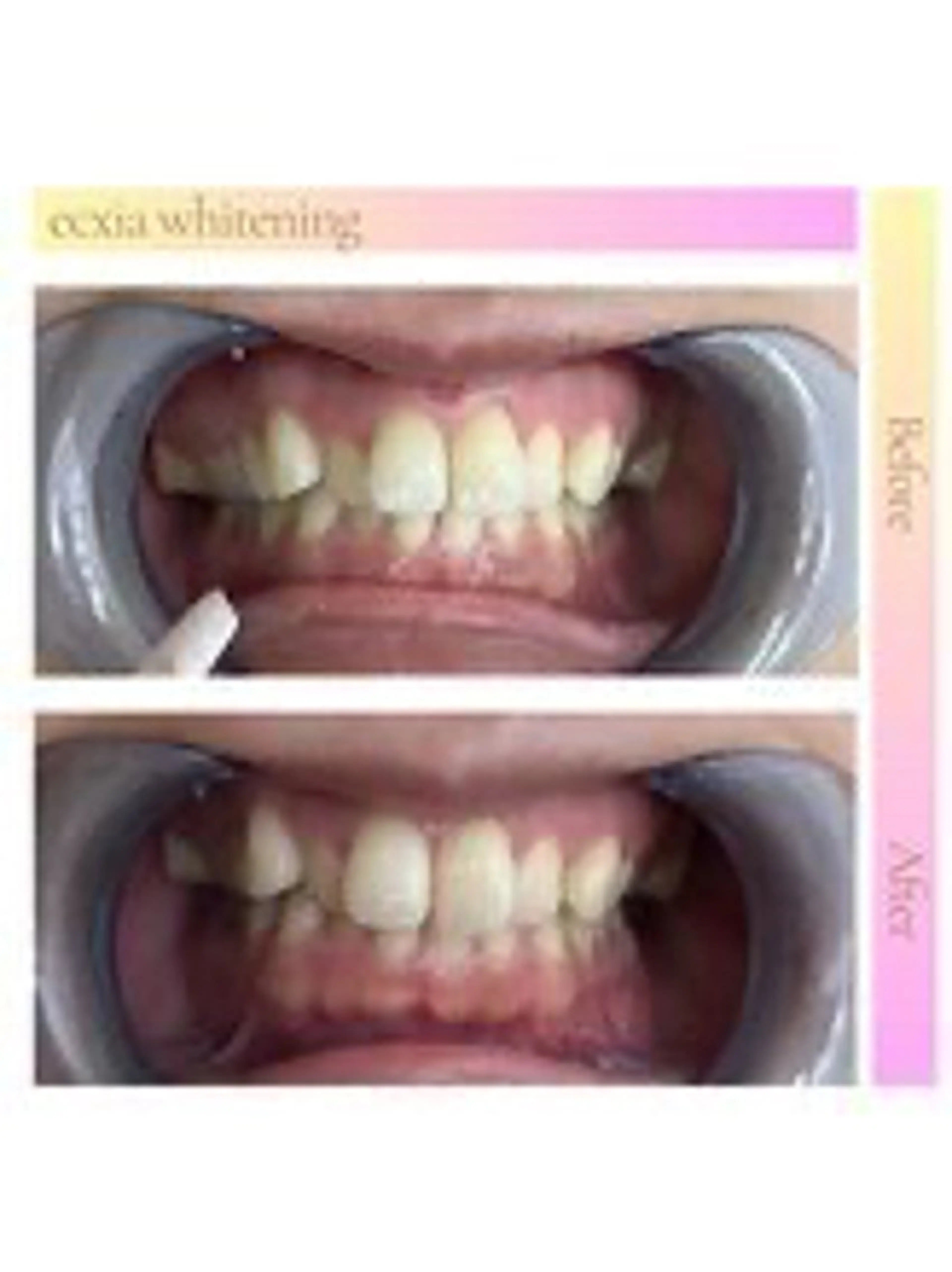 セルフホワイトニング エクシア西宮北口店のその他イメージ