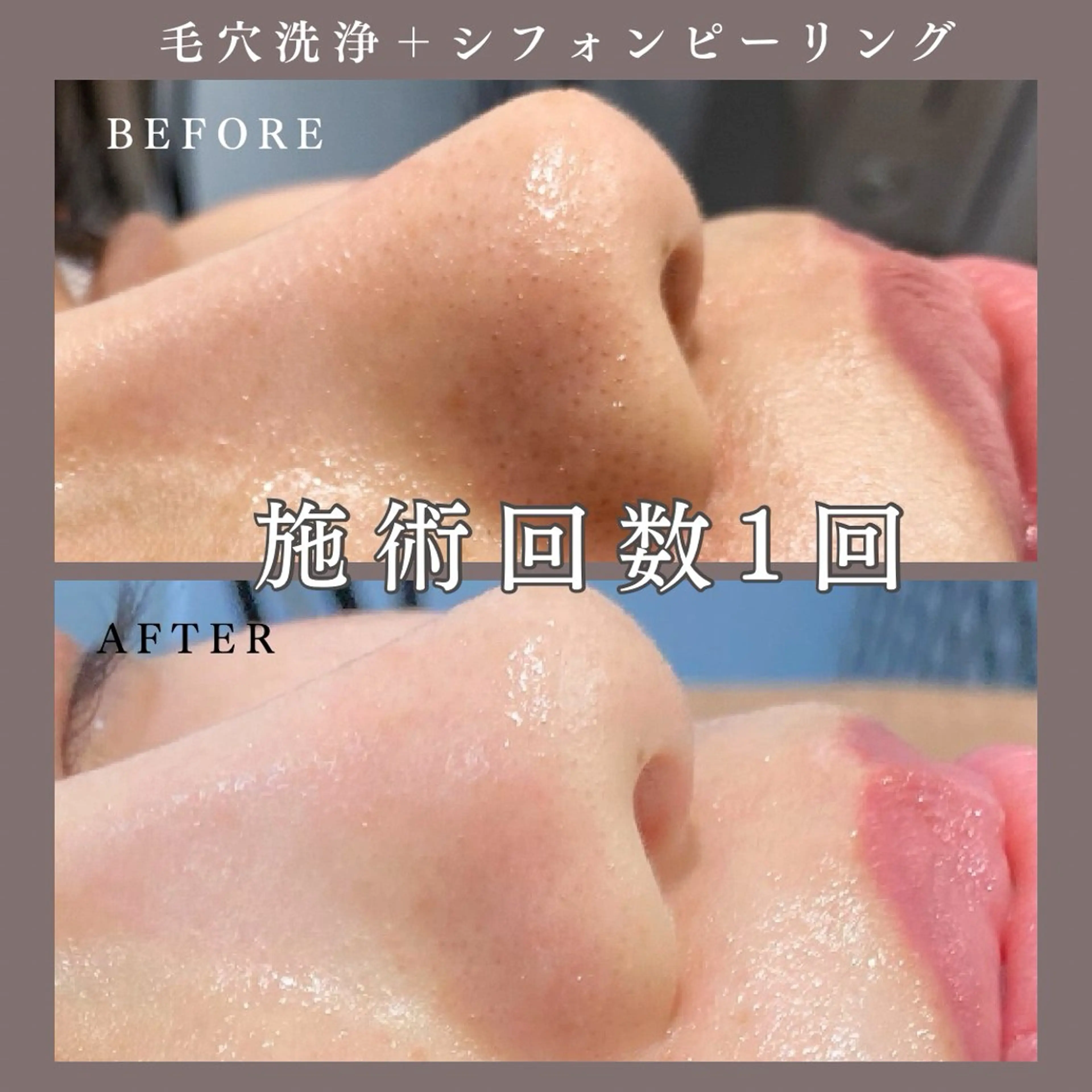 肌質改善専門サロン Bellmi/心斎橋のエステ・リラクイメージ