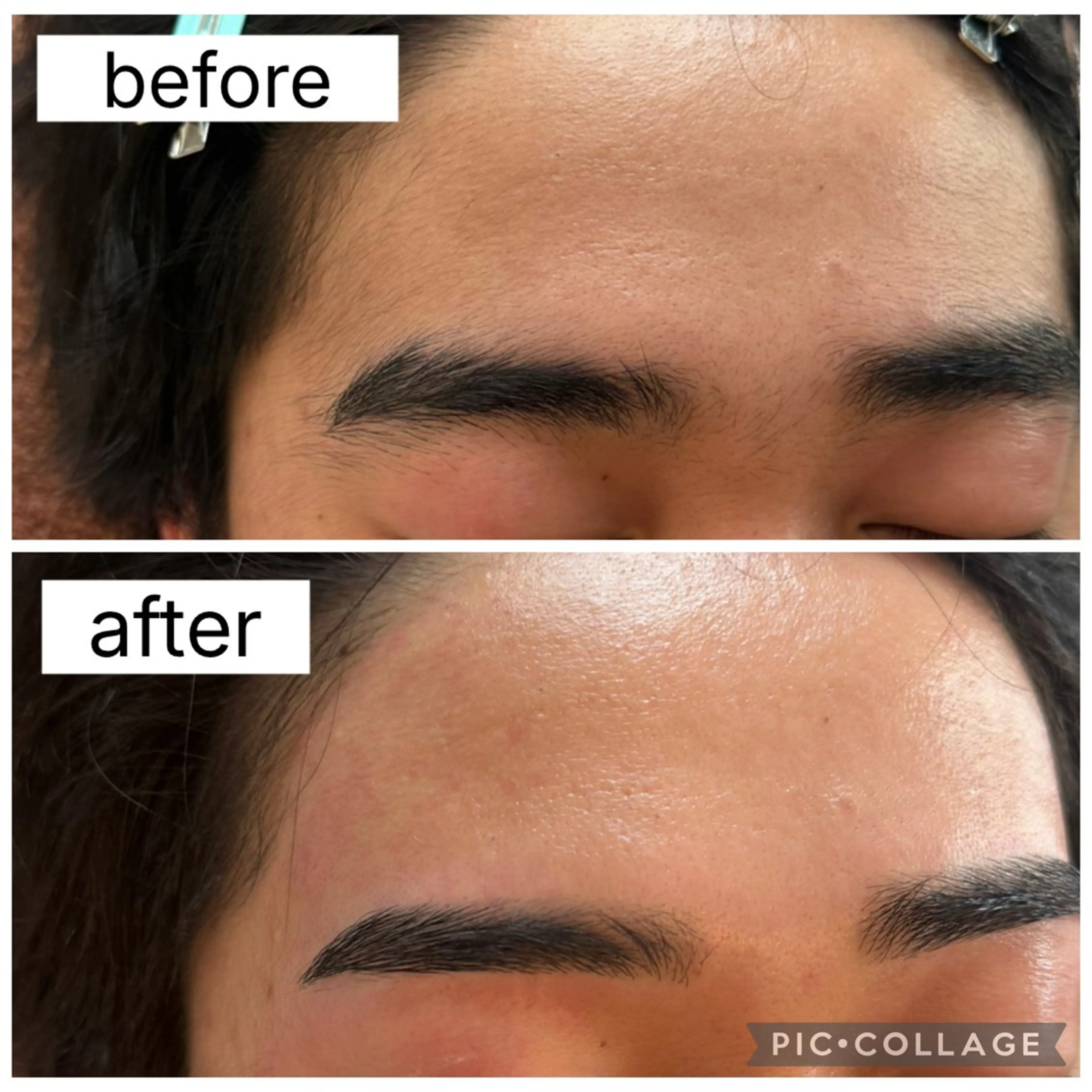 アイブロウ メンズアイブロウ 眉毛ワックス脱毛 ワックス脱毛 その他(アイブロウ) 眉毛/小顔/ハーブ 🌼hikaruの眉毛・アイブロウイメージ
