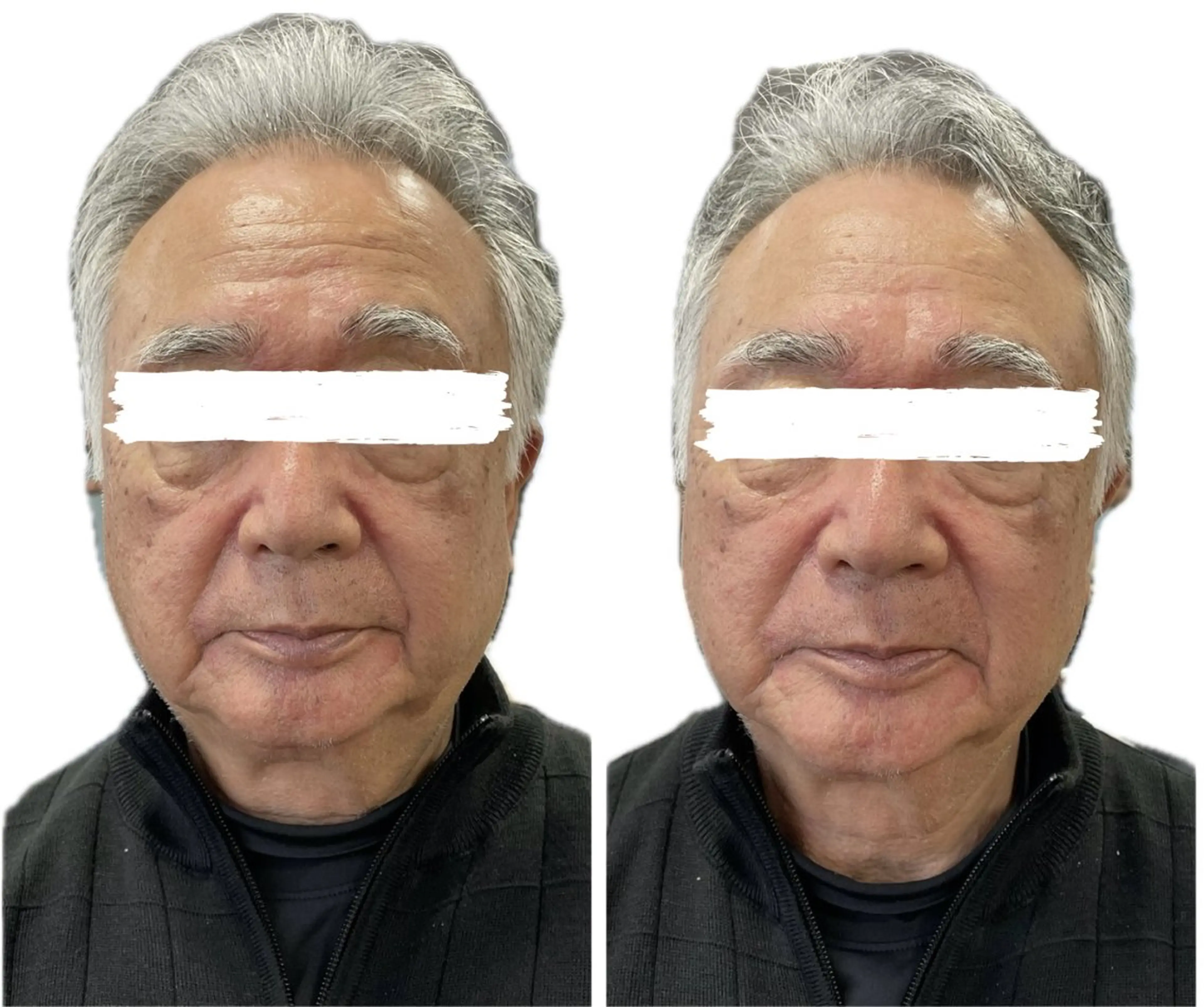 エステ リラク ビューティーサロン フリジアのエステ・リラクイメージ