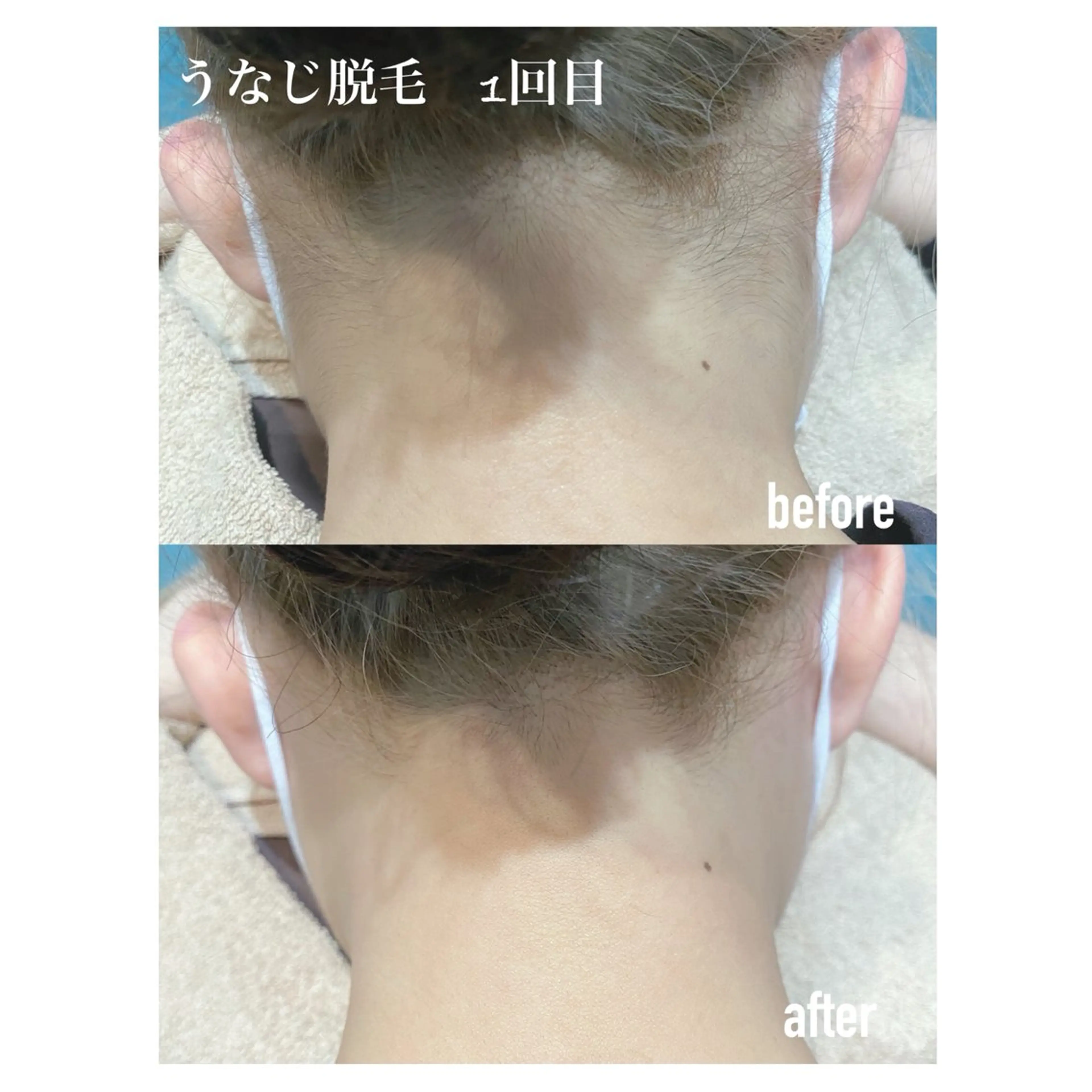 脱毛 M's Style NAIL BARのネイルデザイン