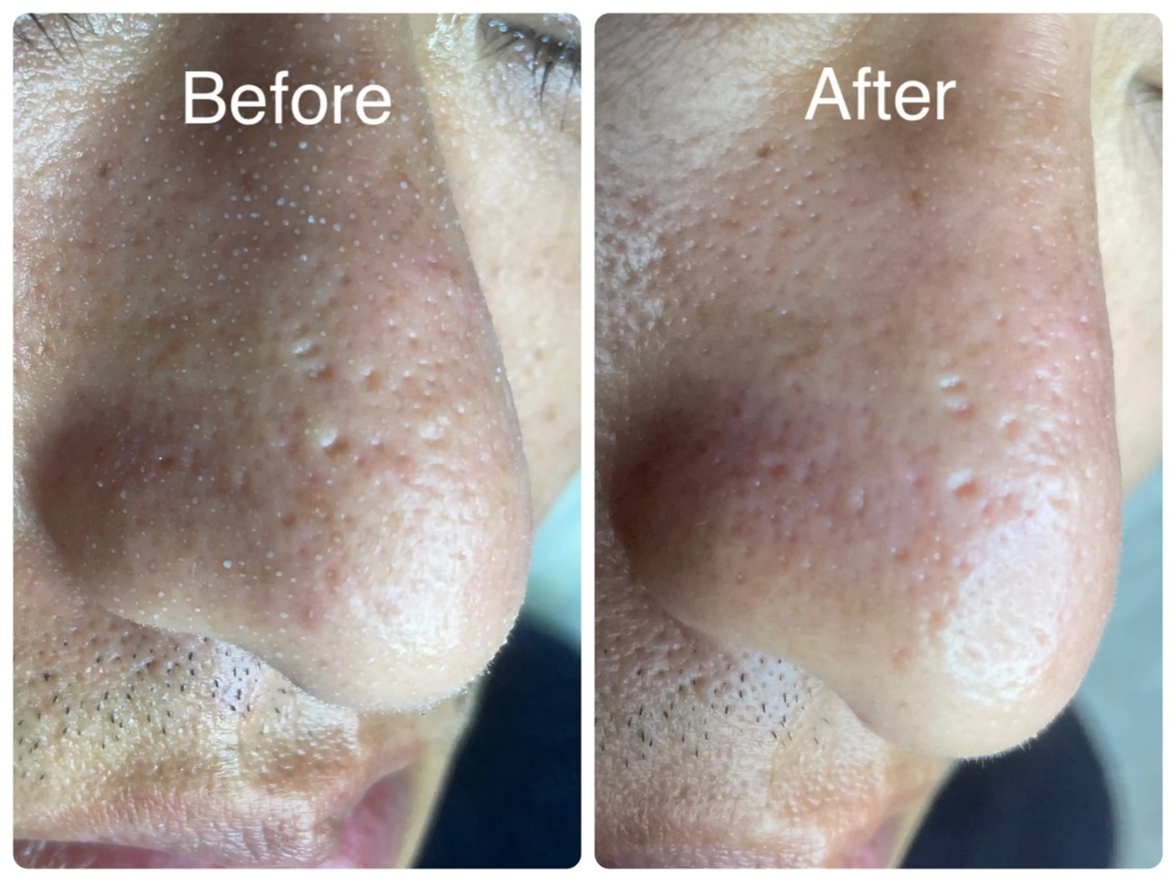 エステ salon HATOのエステ・リラクイメージ