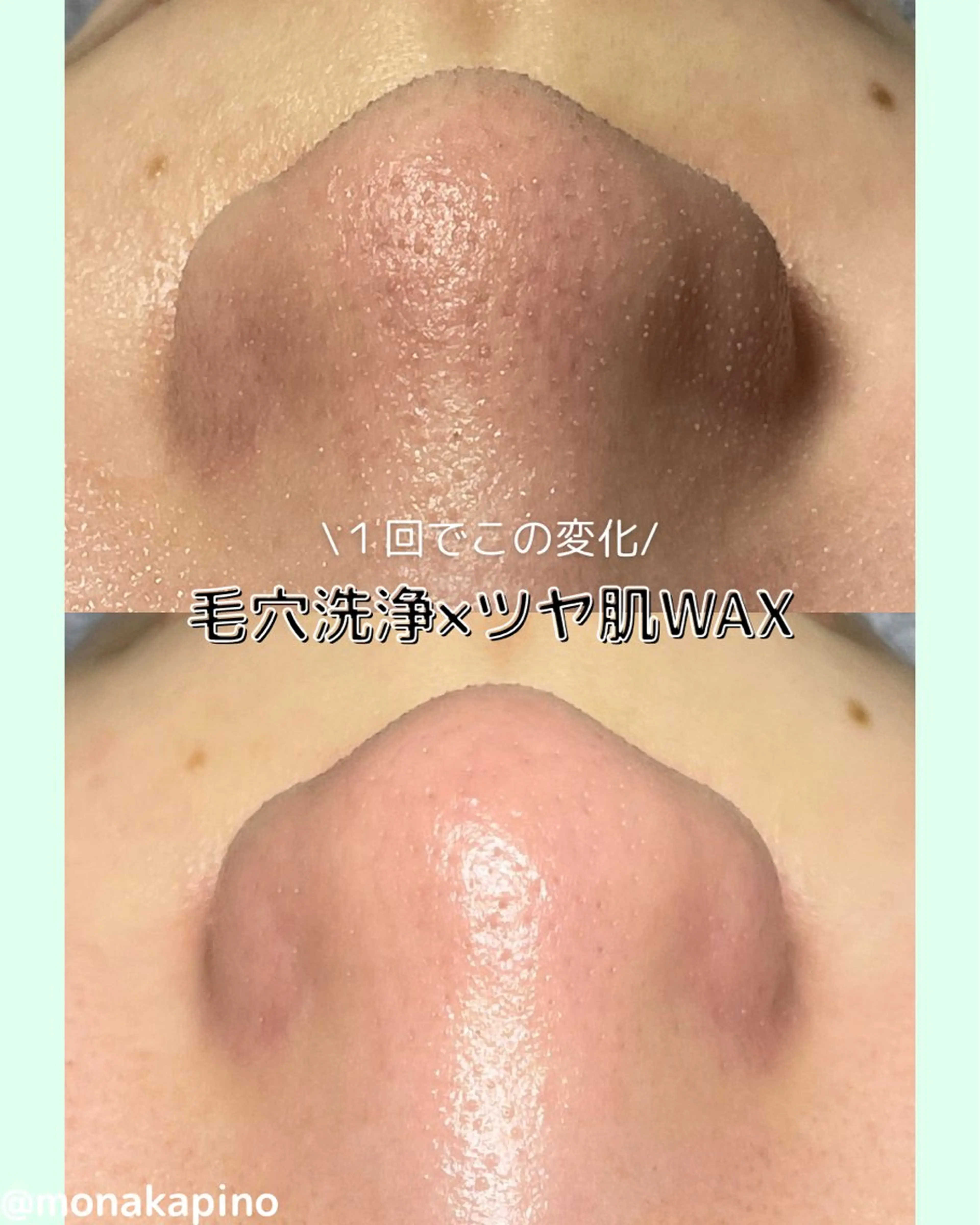 エステ Diailes 💎ななのエステ・リラクイメージ