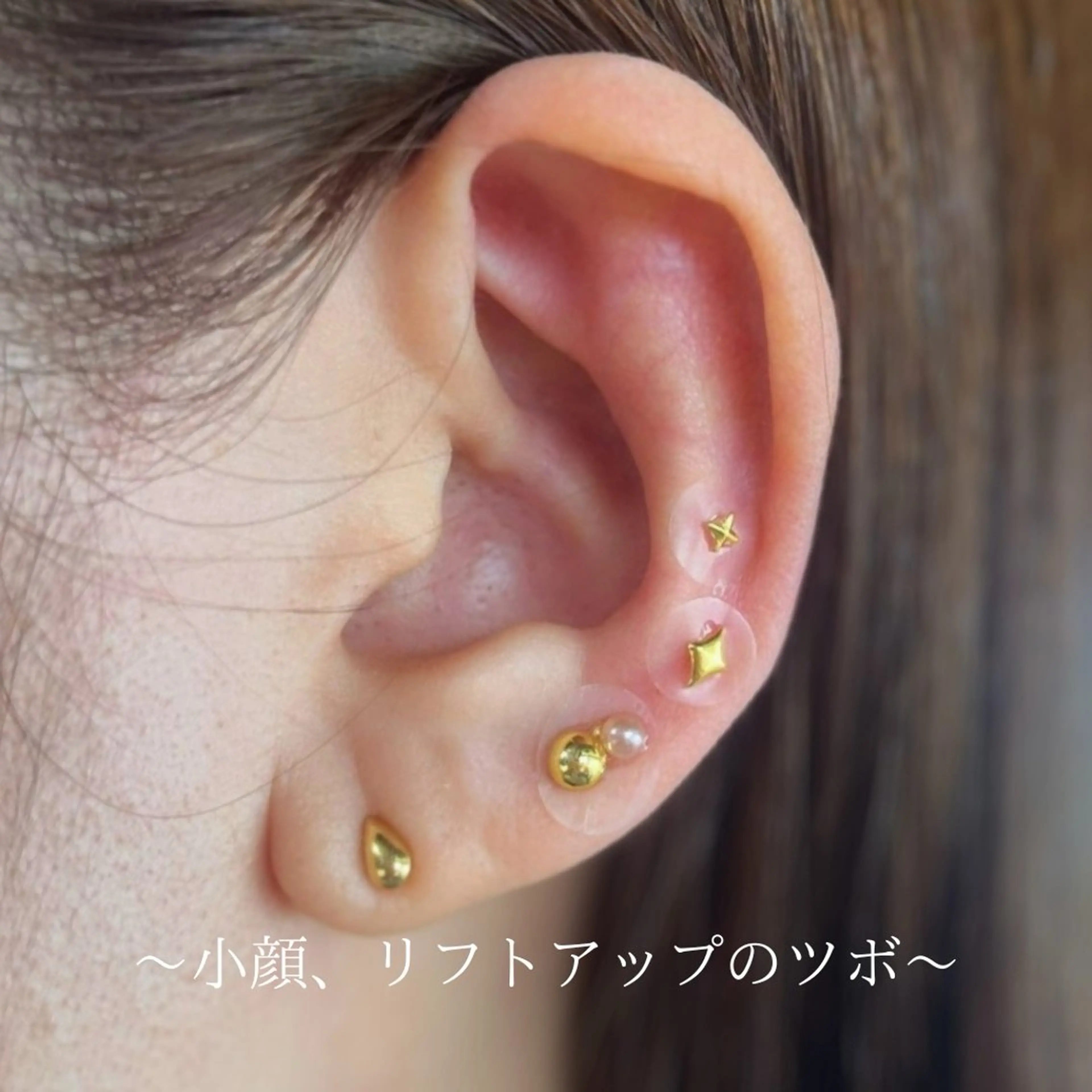 耳つぼジュエリー　【小顔、リフトアップのツボ】の写真