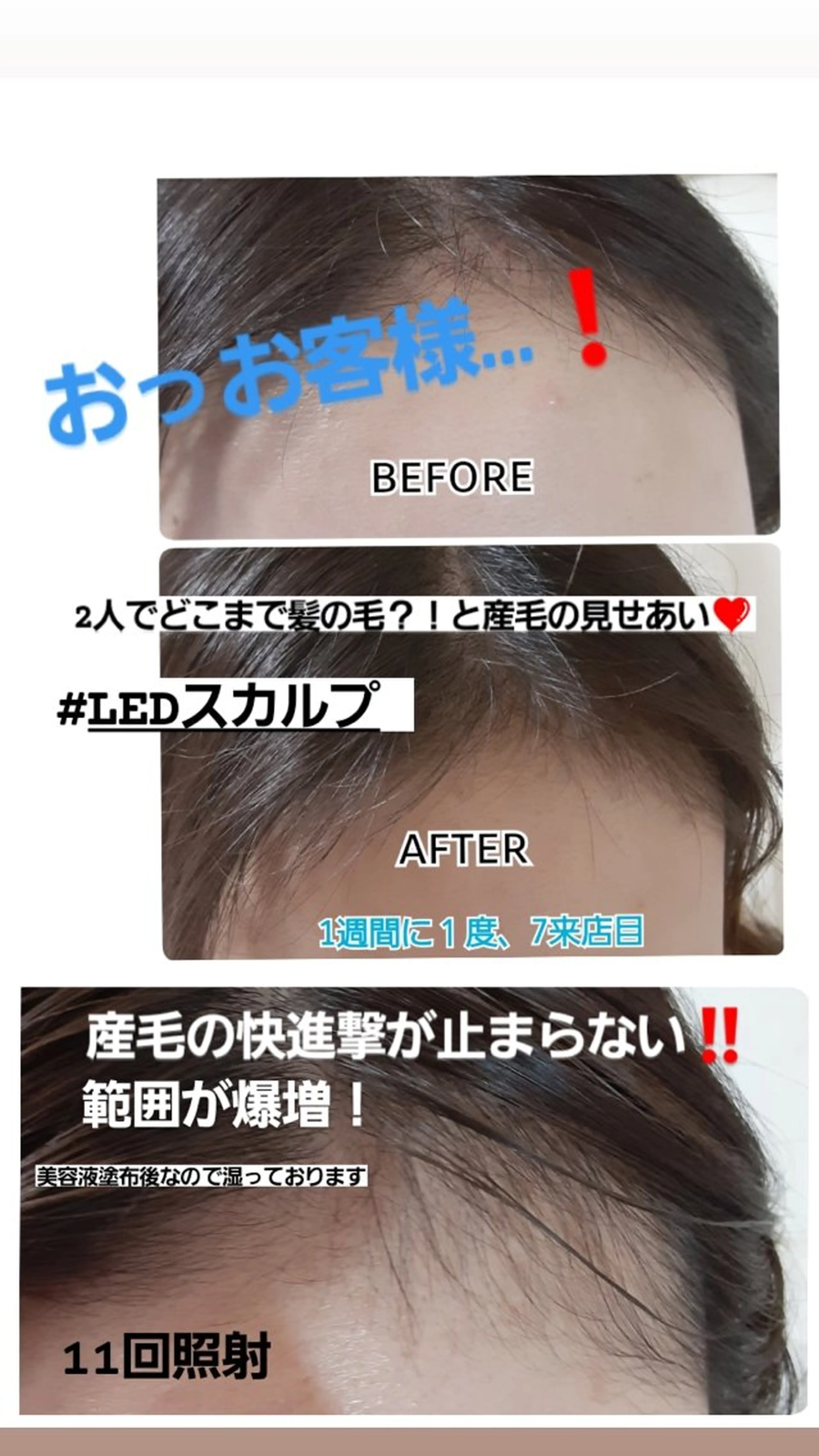 ヘッドスパ 五十嵐 蓮のその他イメージ