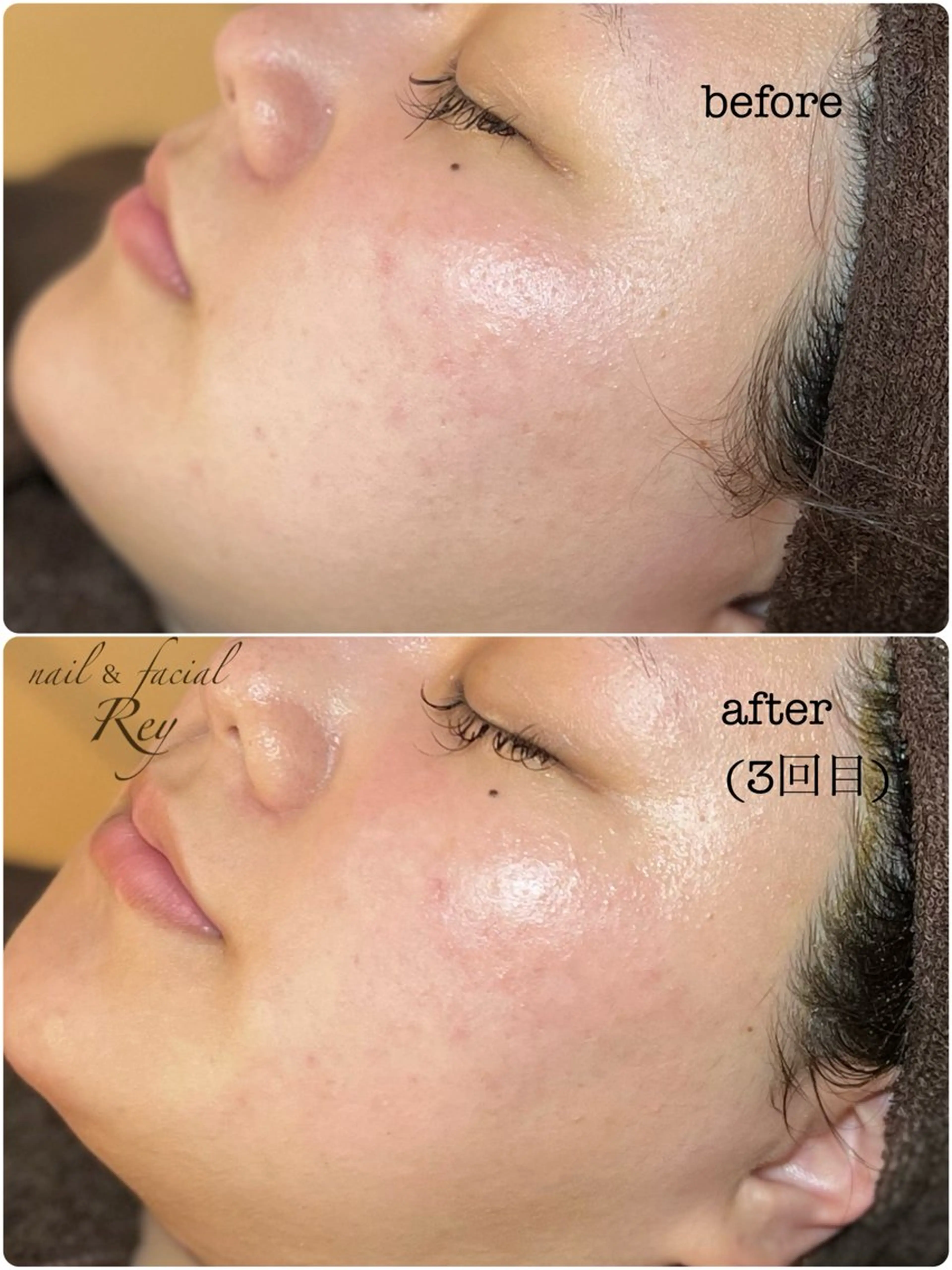 エステ R eyのネイルデザイン