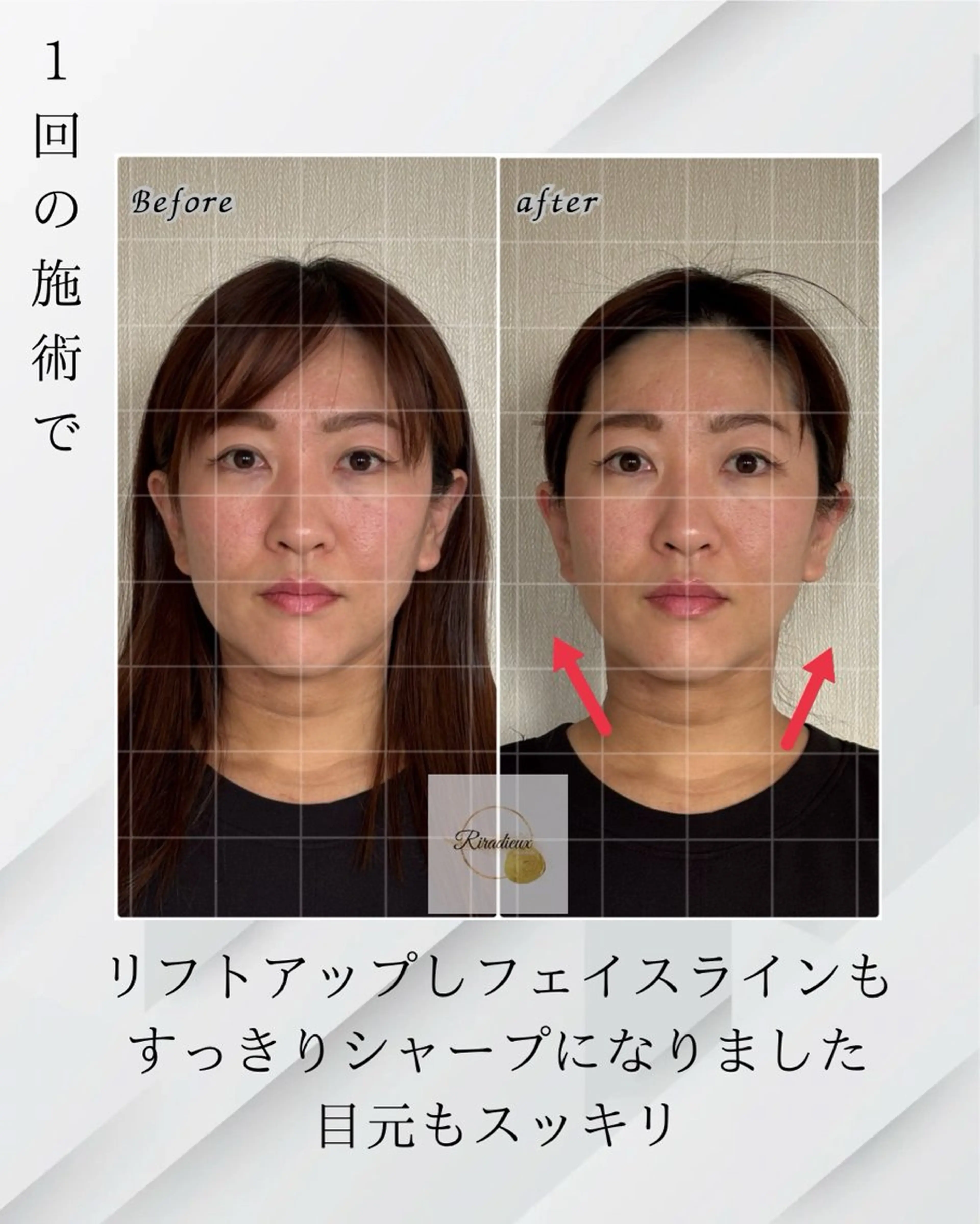 モニター募集！写真掲載可能な方2,000円の写真