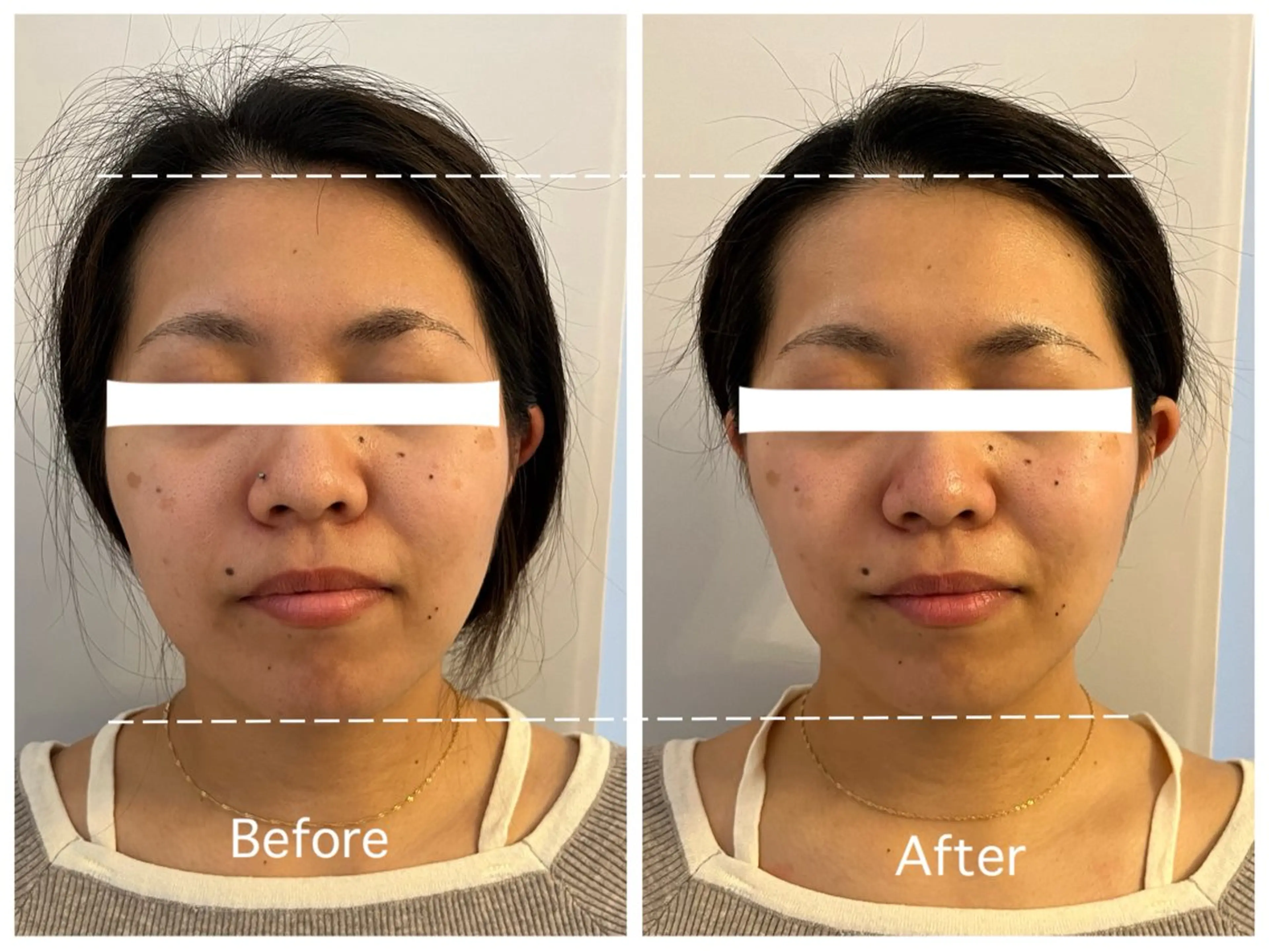 エステ AnLimit 當山杏奈のエステ・リラクイメージ