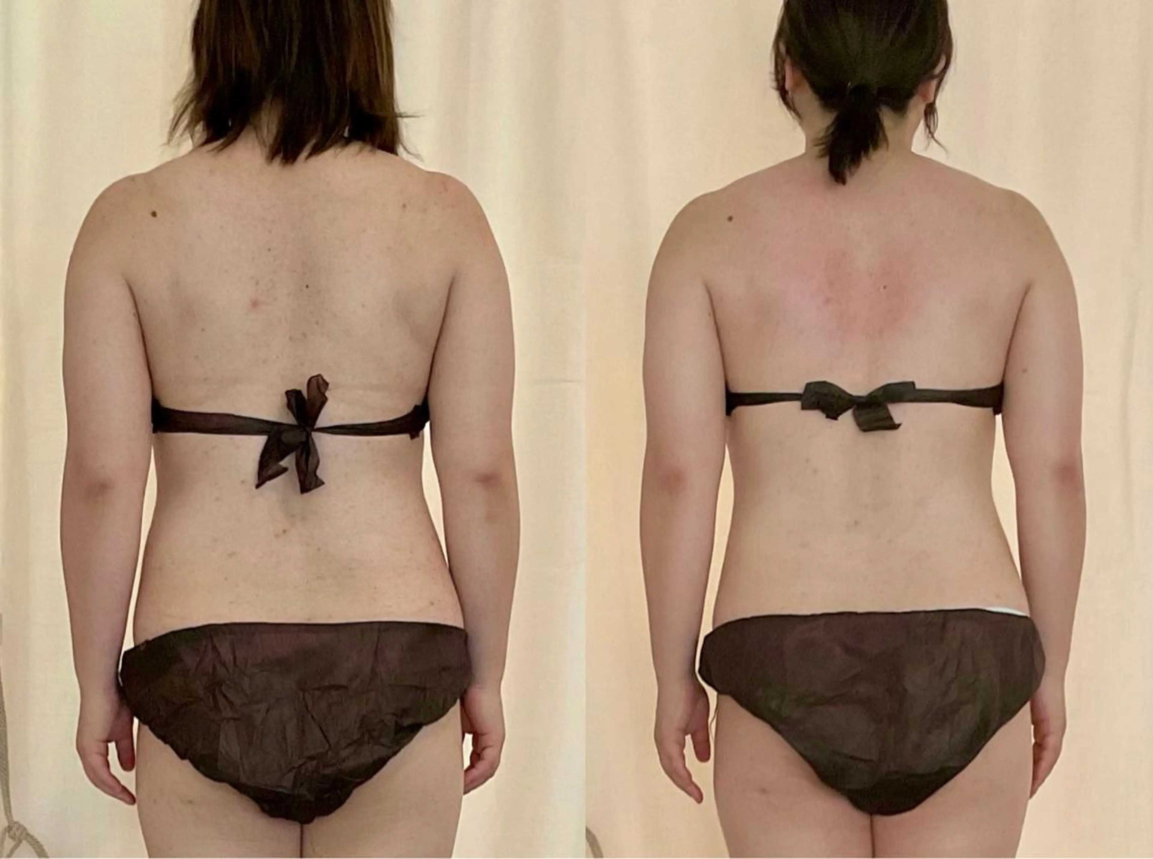 エステ リラク Diamedel所属・柴田 知里のエステ・リラクイメージ