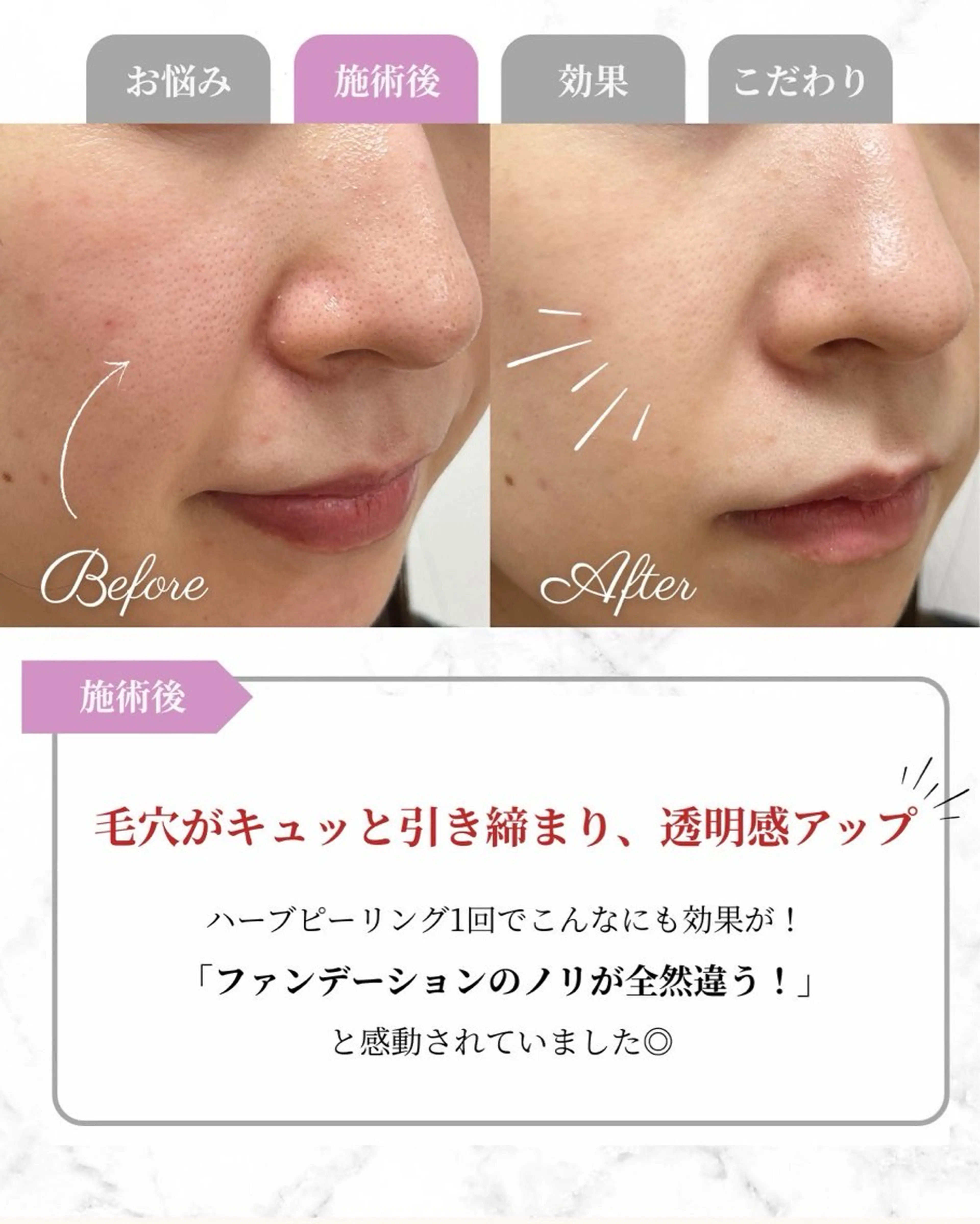 その他 Astorie 相模大野エステのその他イメージ