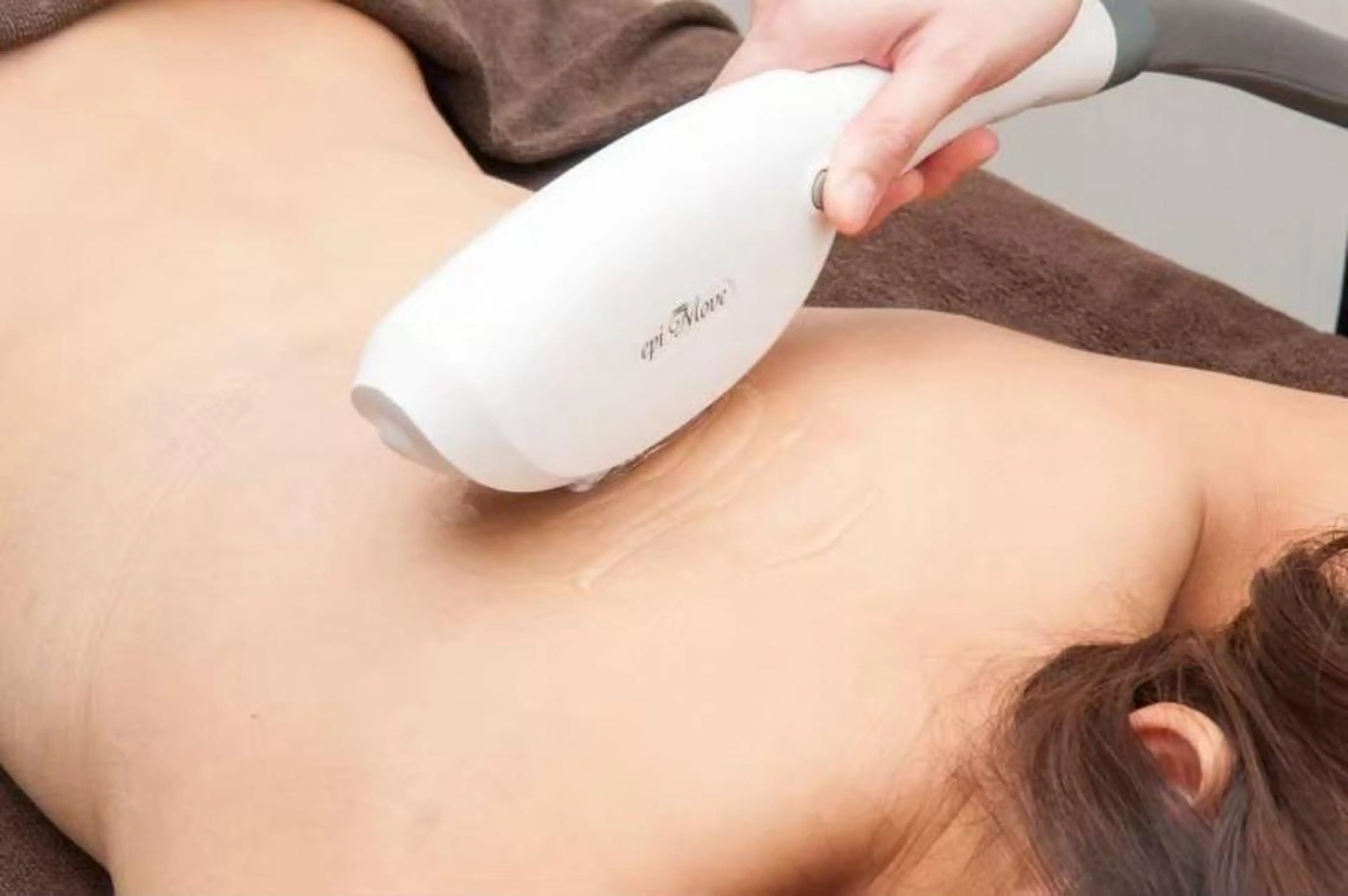 【女性】2.3回目の方🫶全身顔脱毛(VIO含む)の写真