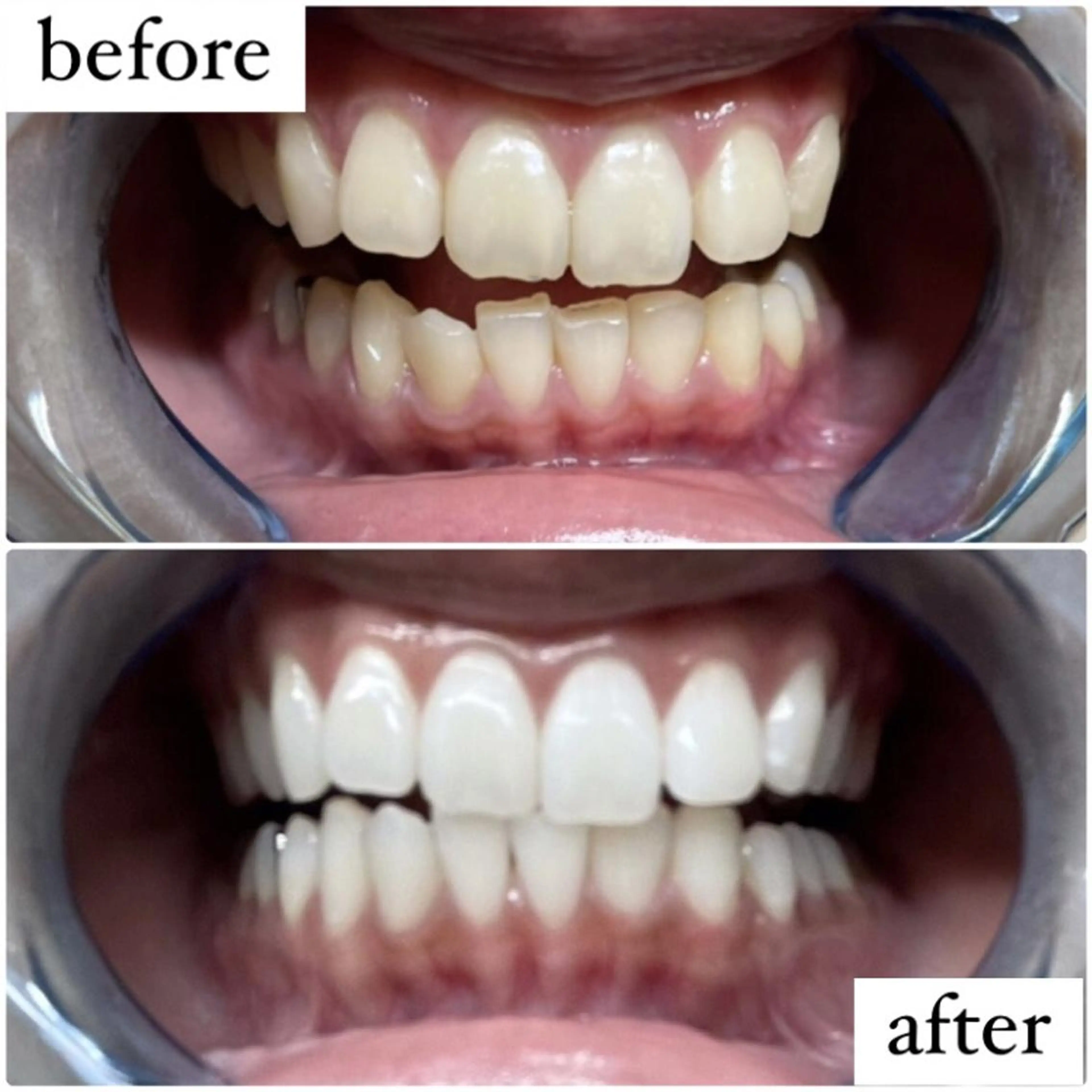 その他 ホワイトニング専門店 LCS 汐留店 森田のその他イメージ