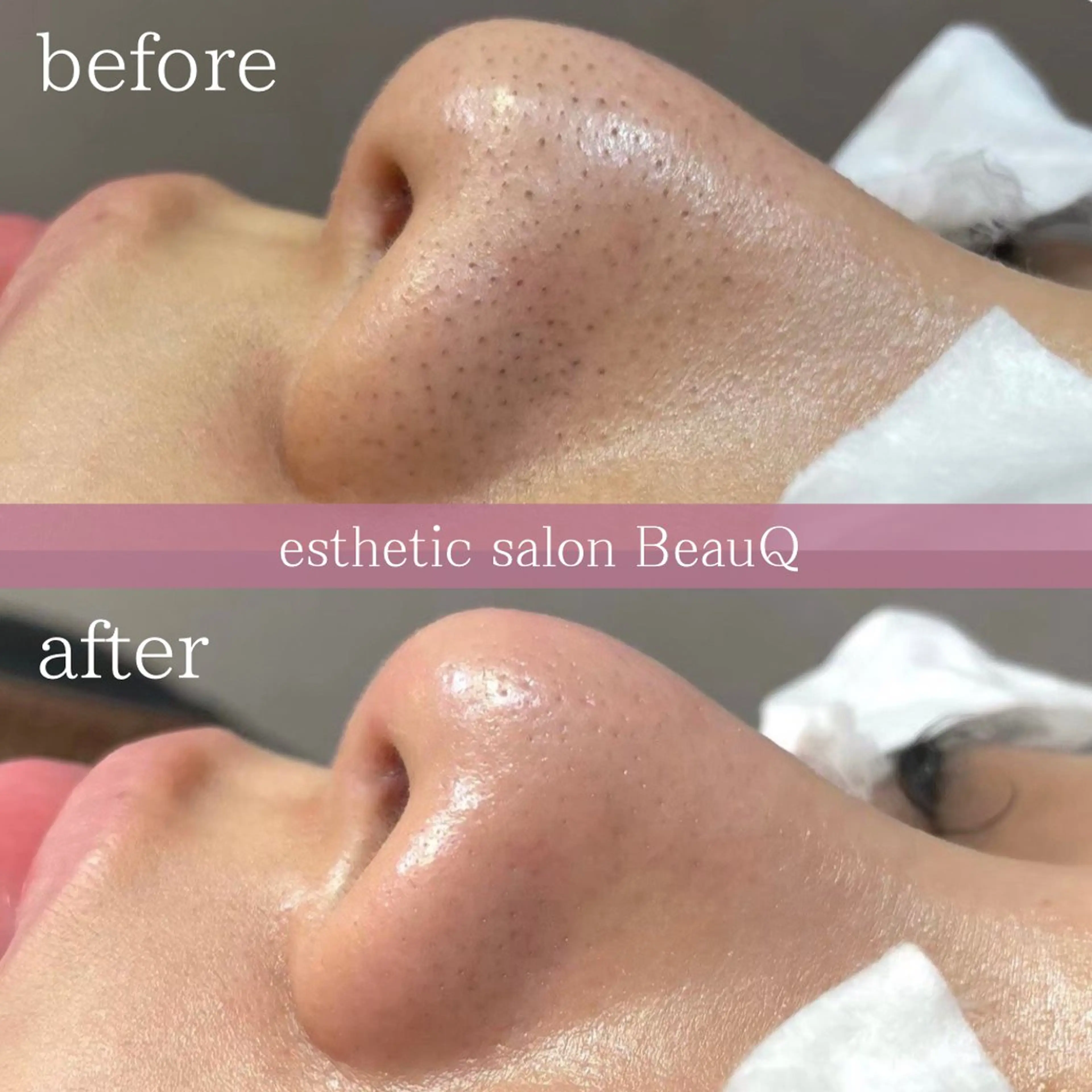 肌質改善/ブライダル 水上百華のエステ・リラクイメージ