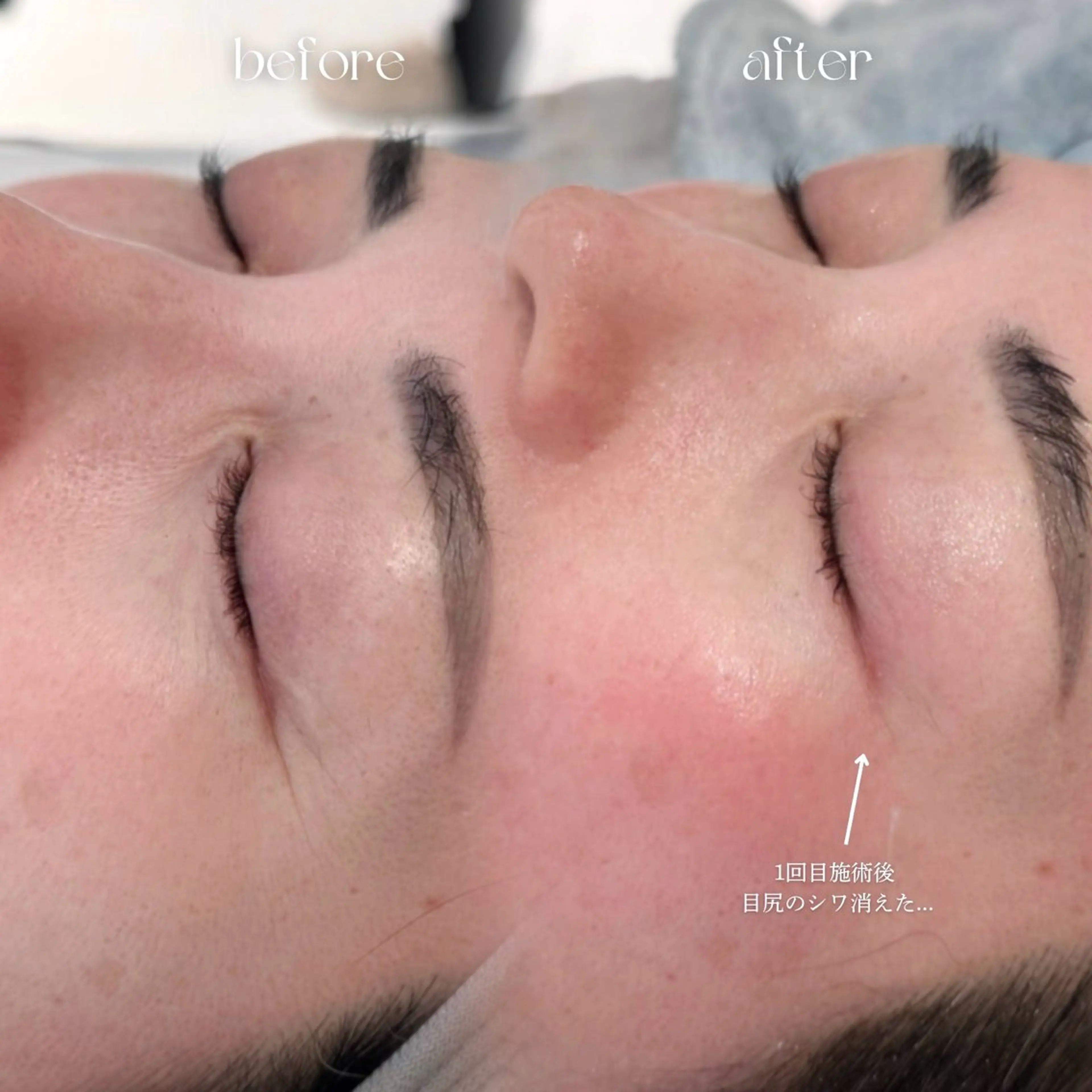 enam.所属・enam.梅田 / 肌育ハーブピーリングのエステ・リラクイメージ