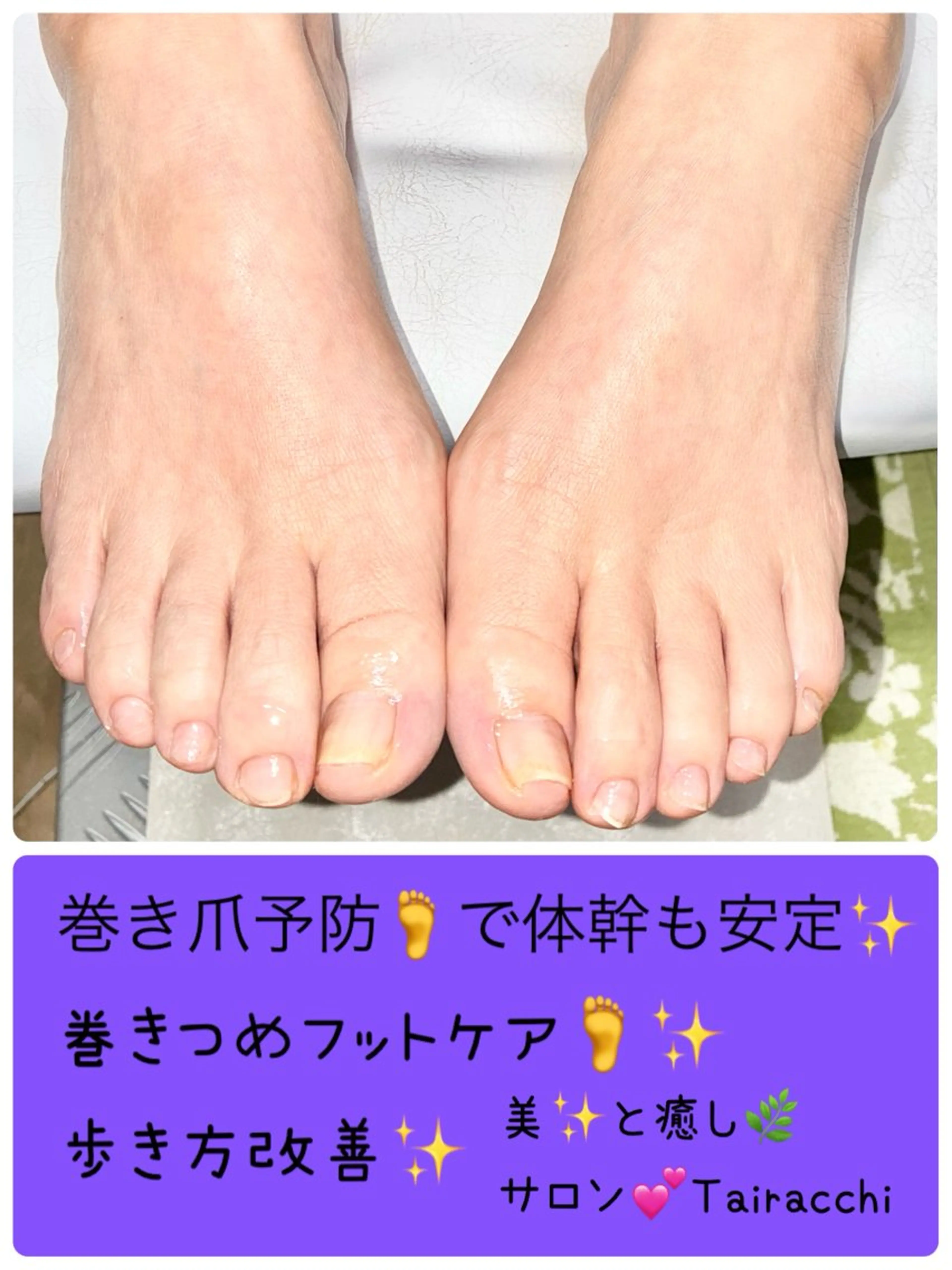 ネイル フットネイル フットネイル Tairacchi ﾀｲﾗｯﾁのエステ・リラクイメージ