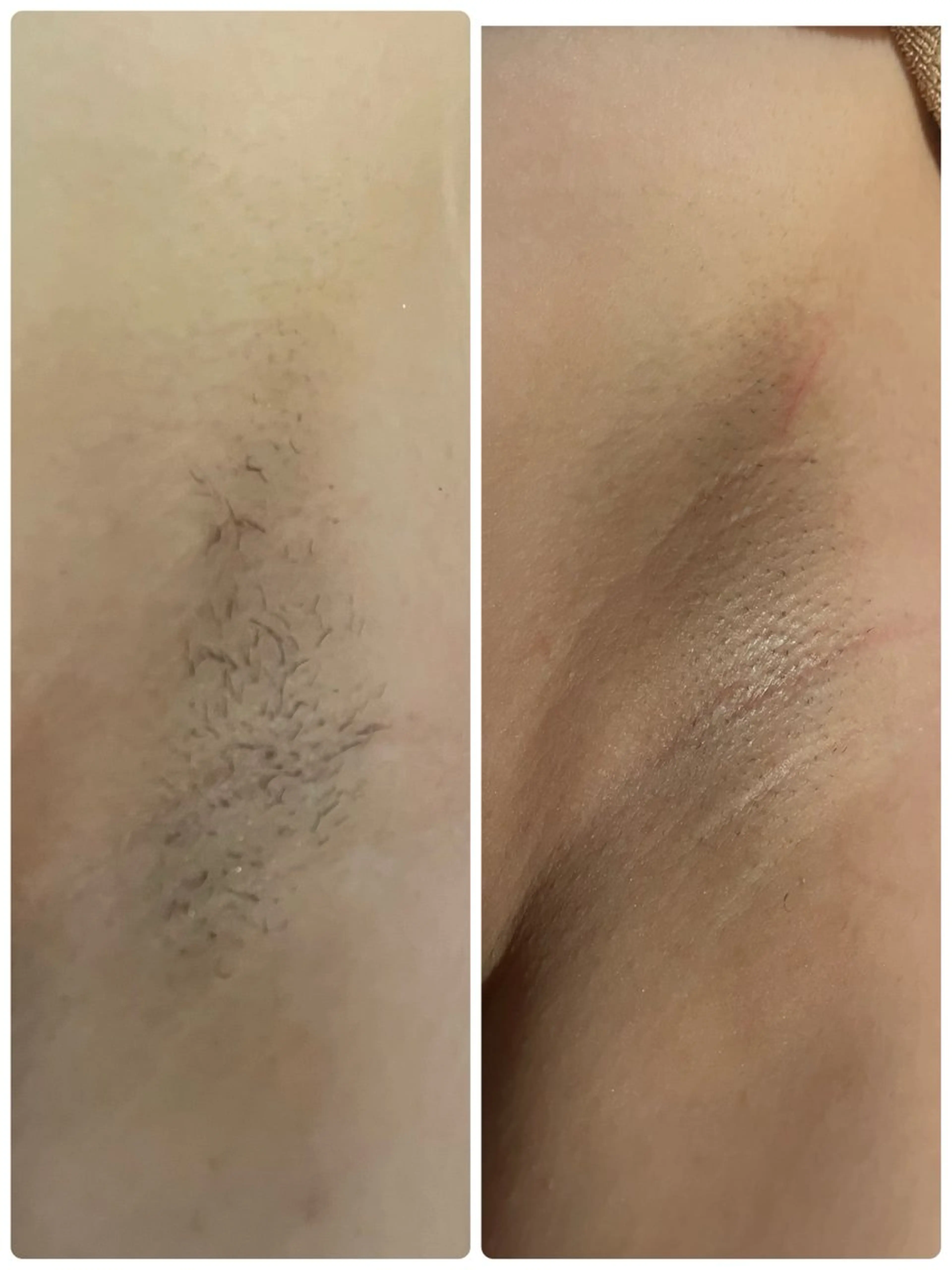 脱毛 エステティック sala藤沢のエステ・リラクイメージ