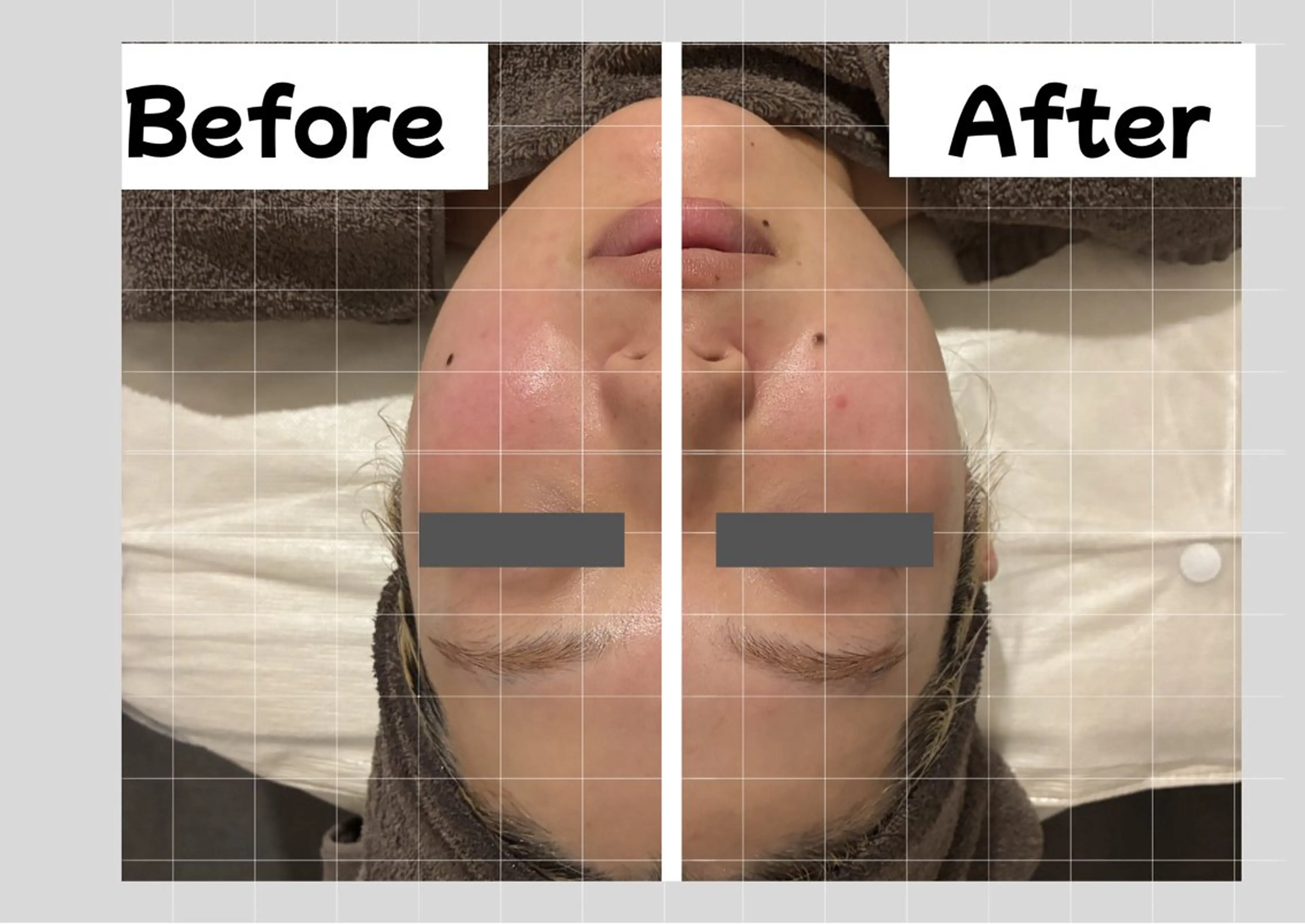 エステ CHERIE所属・CHERIE Akaneのエステ・リラクイメージ