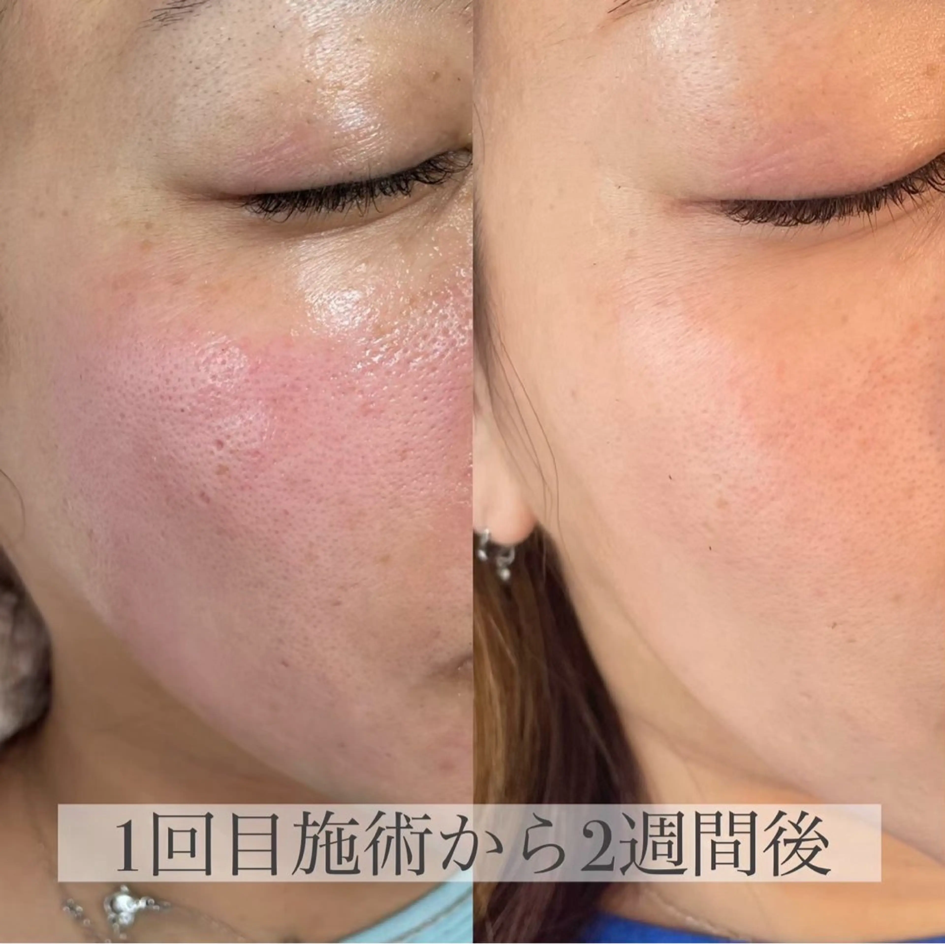 LUVRE龍田 MIKIまつ毛/眉毛の眉毛・アイブロウイメージ