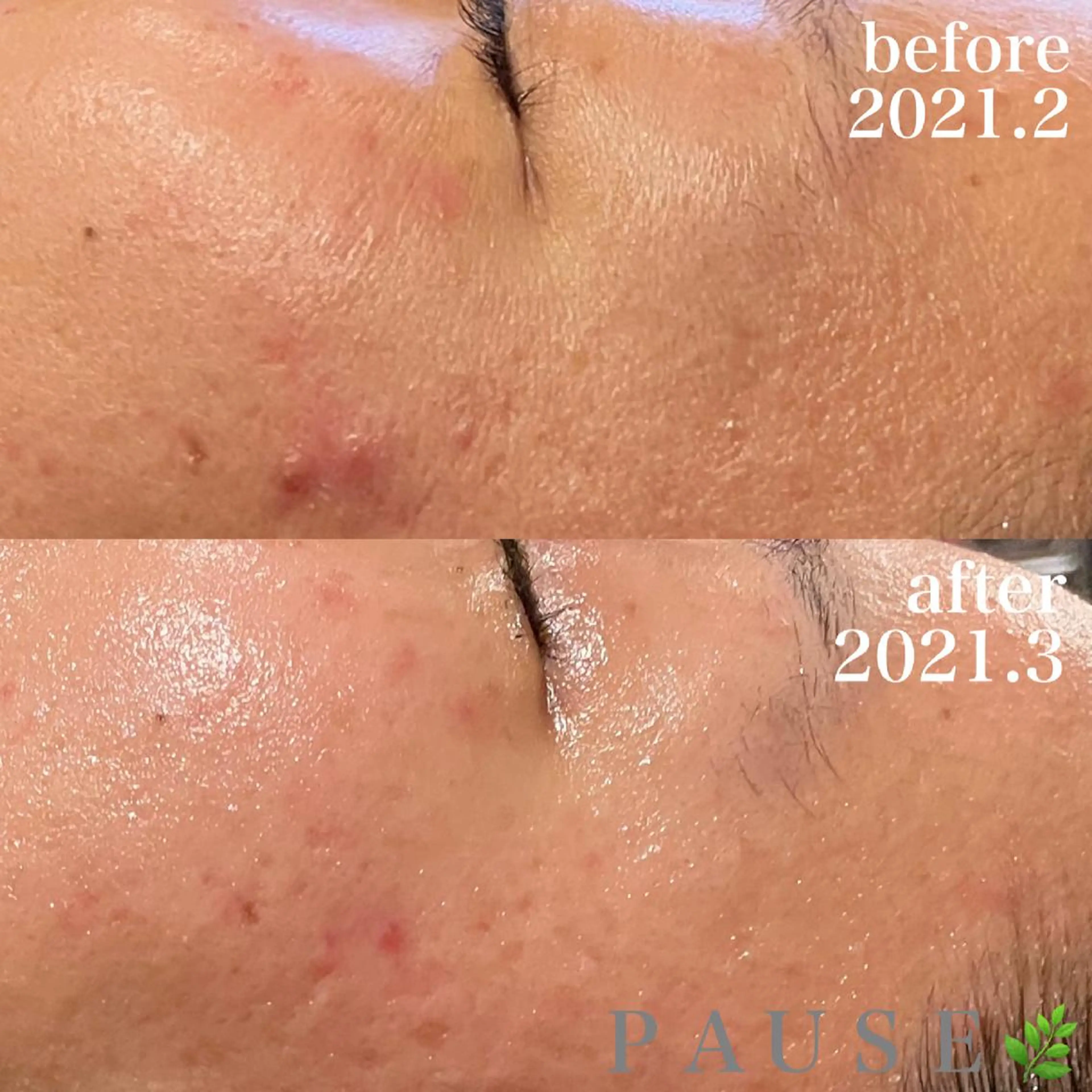 エステ 浜野 恵美のエステ・リラクイメージ