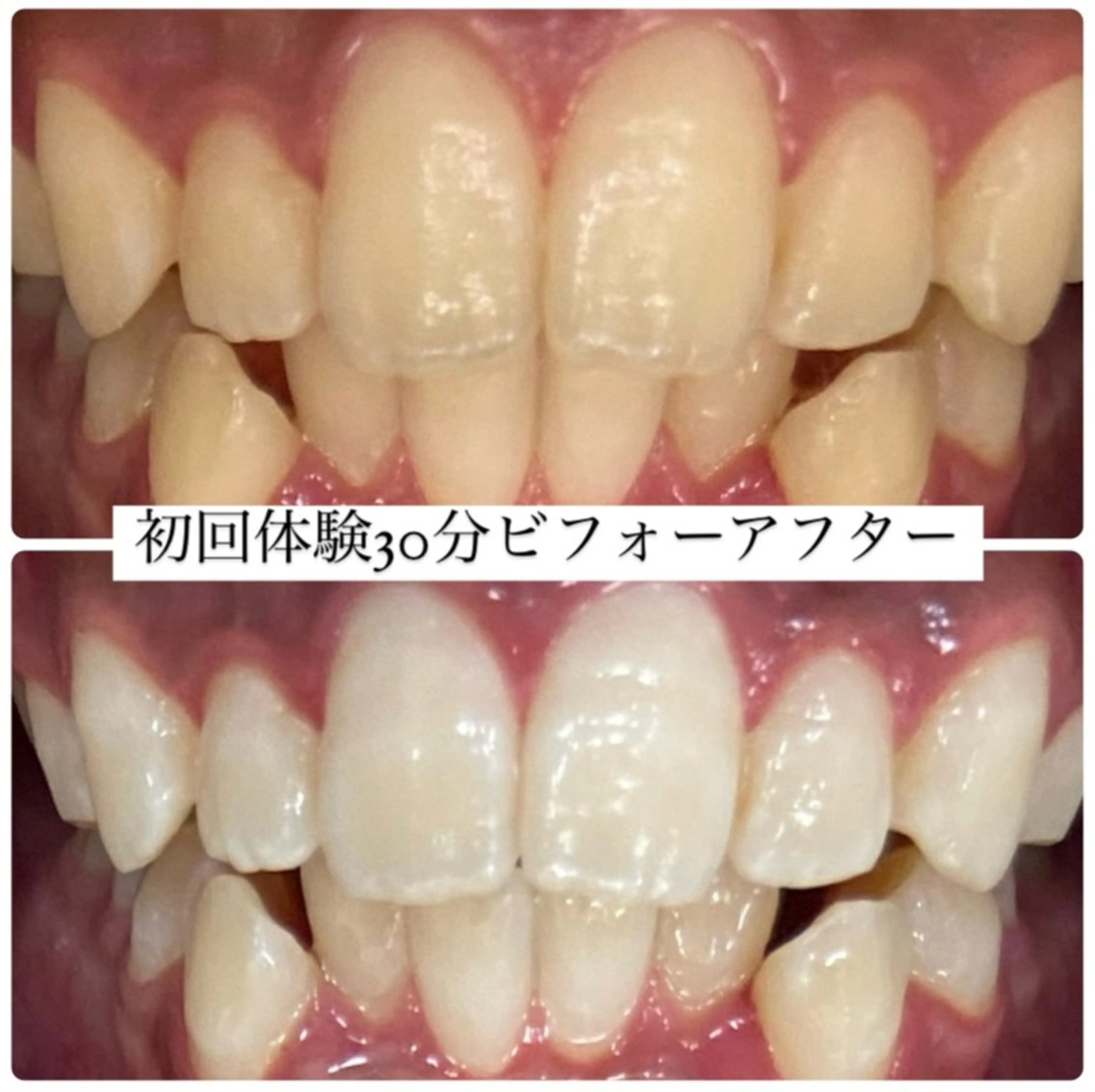 ホワイトニングルーム 横浜店のその他イメージ