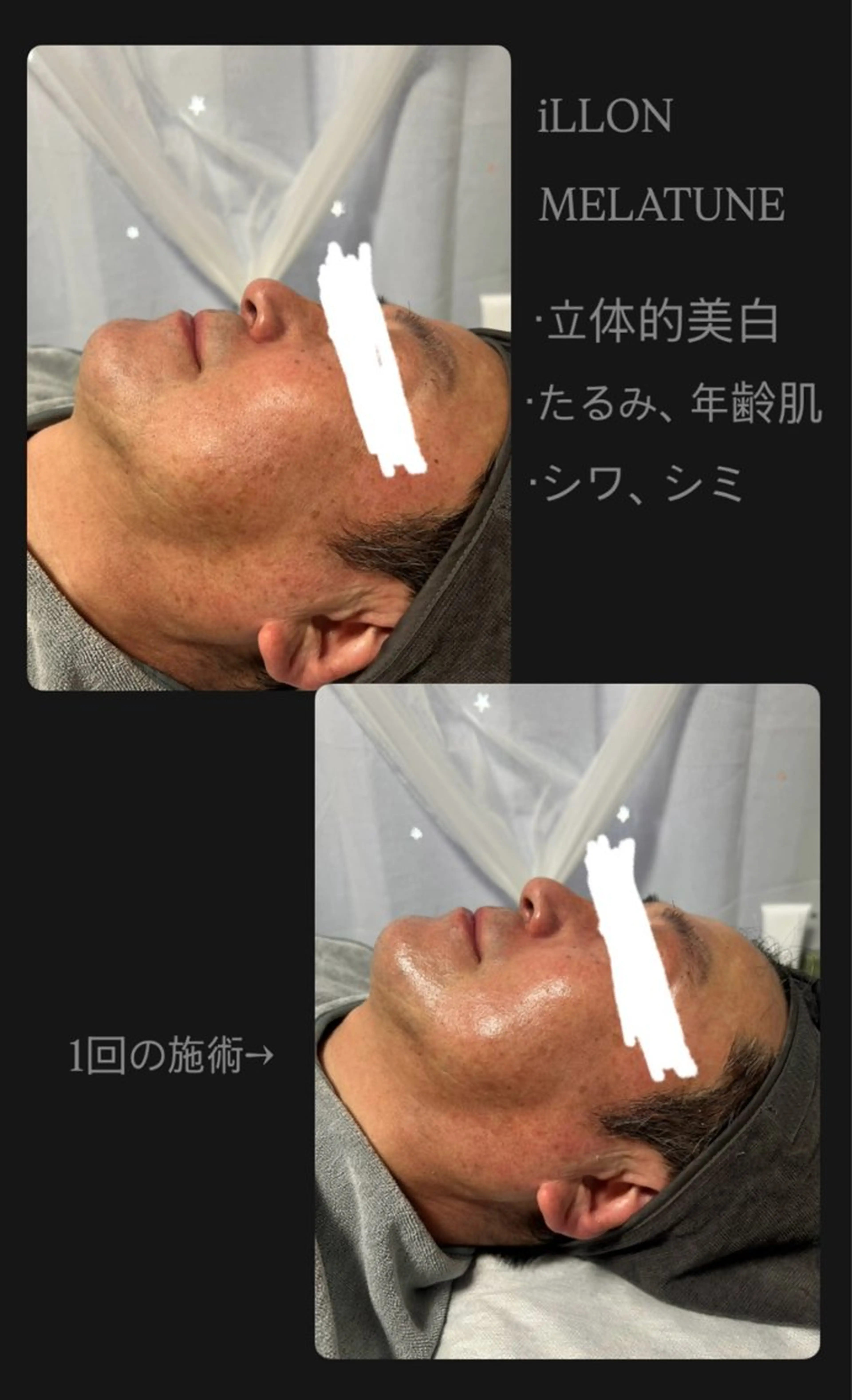 Myuraオーナー MIYUのエステ・リラクイメージ