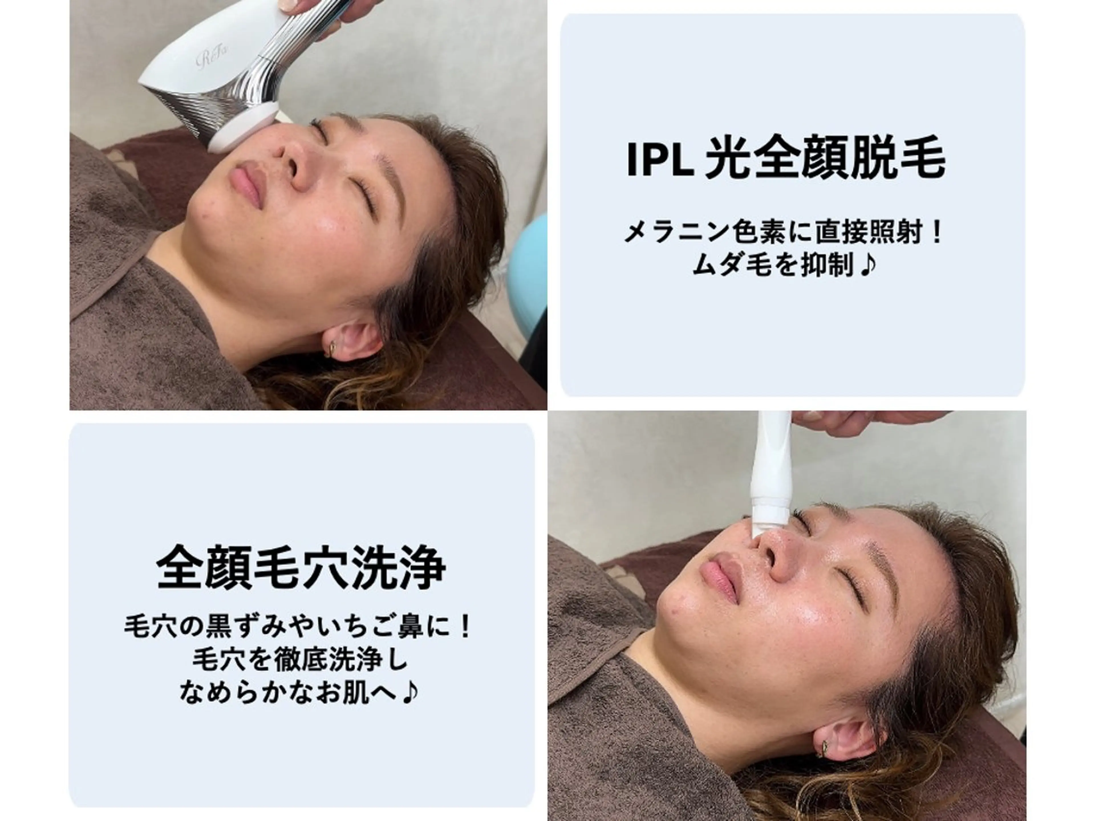 【毛穴洗浄＋全顔光脱毛】ツルツル！毛穴もムダ毛もキレイに♪黒ずみ鼻にも◎の写真