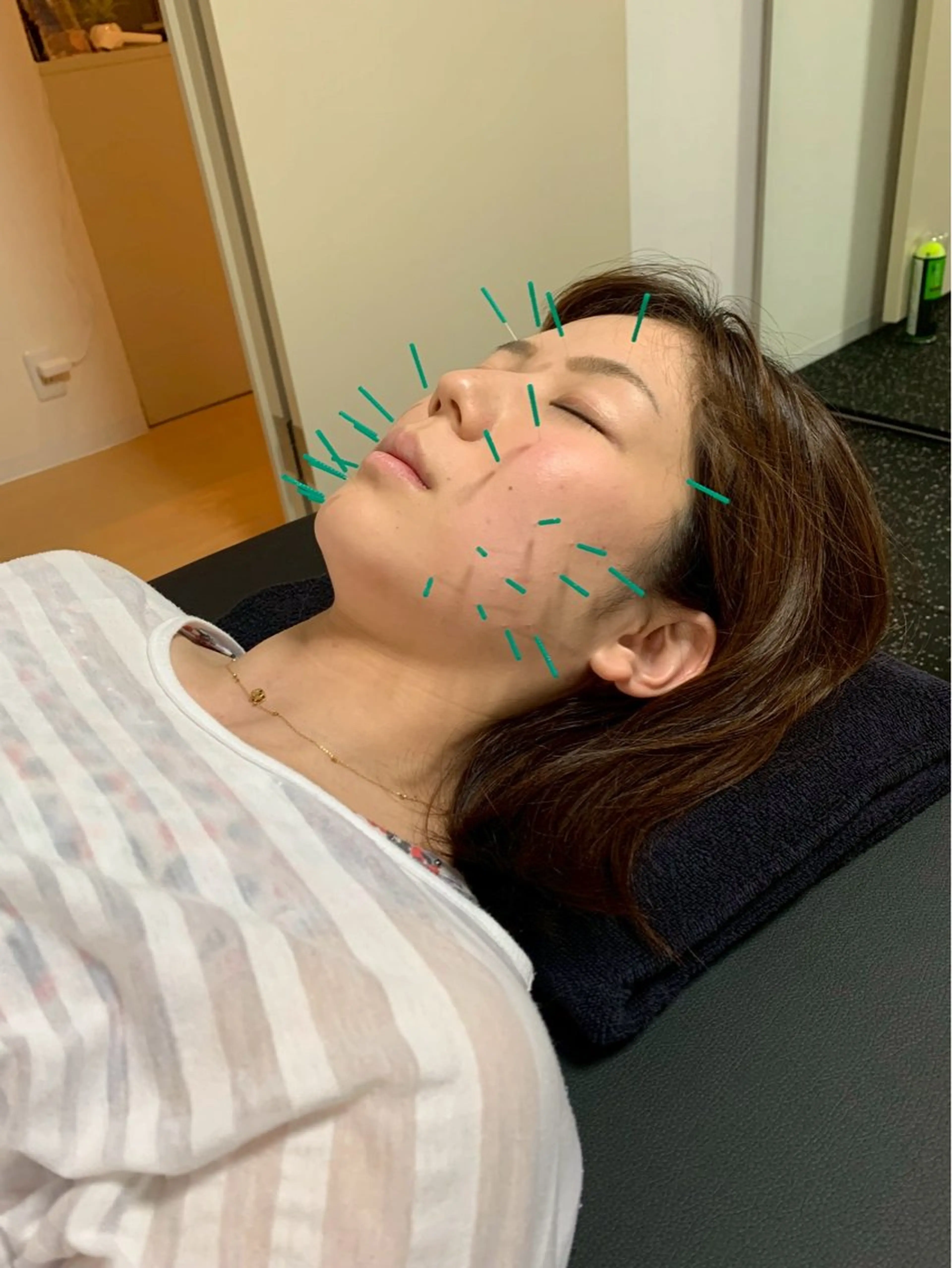 美容鍼・小顔矯正 FLOW 鍼灸整体院のその他イメージ