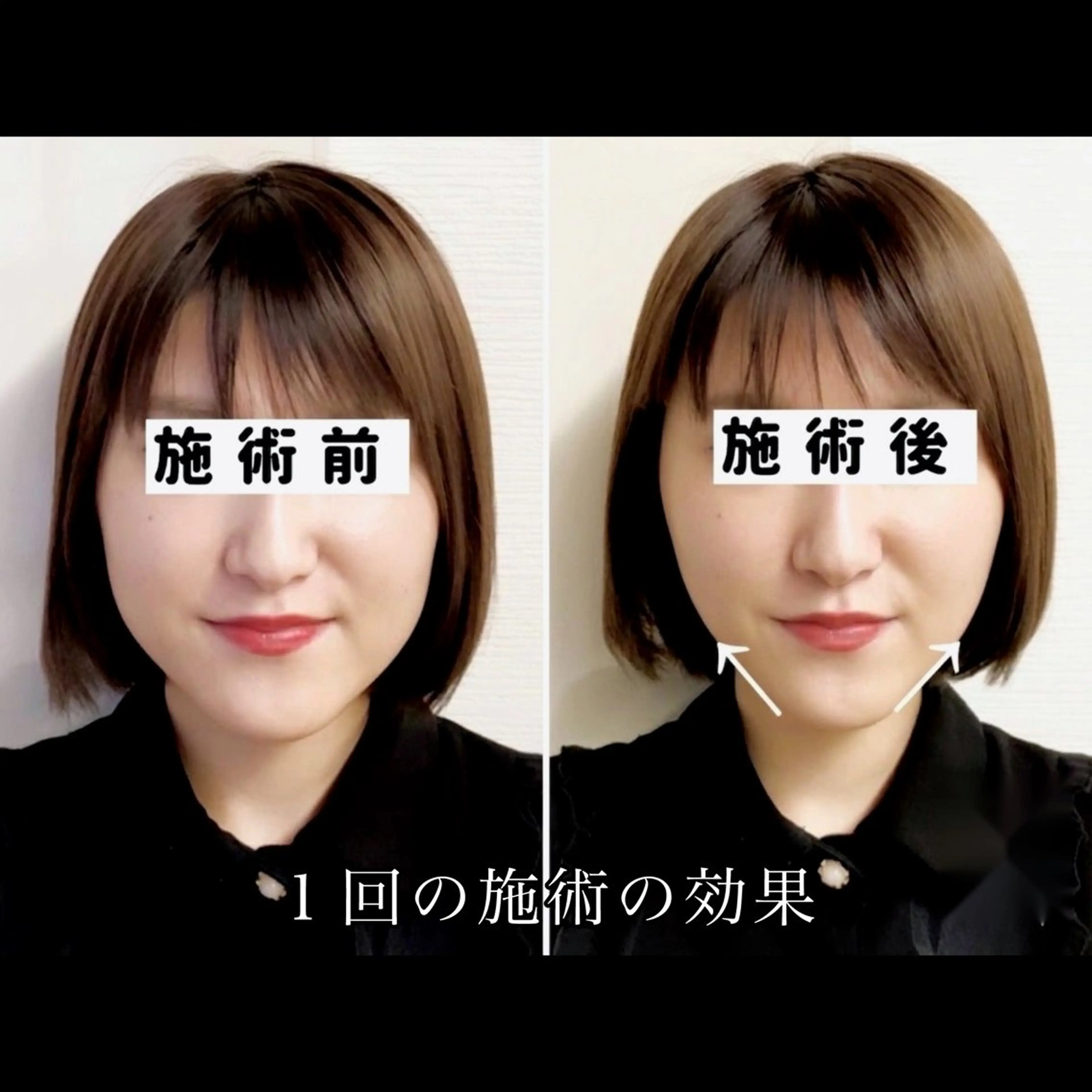 渋谷 小顔美容鍼 専門サロン YZのエステ・リラクイメージ