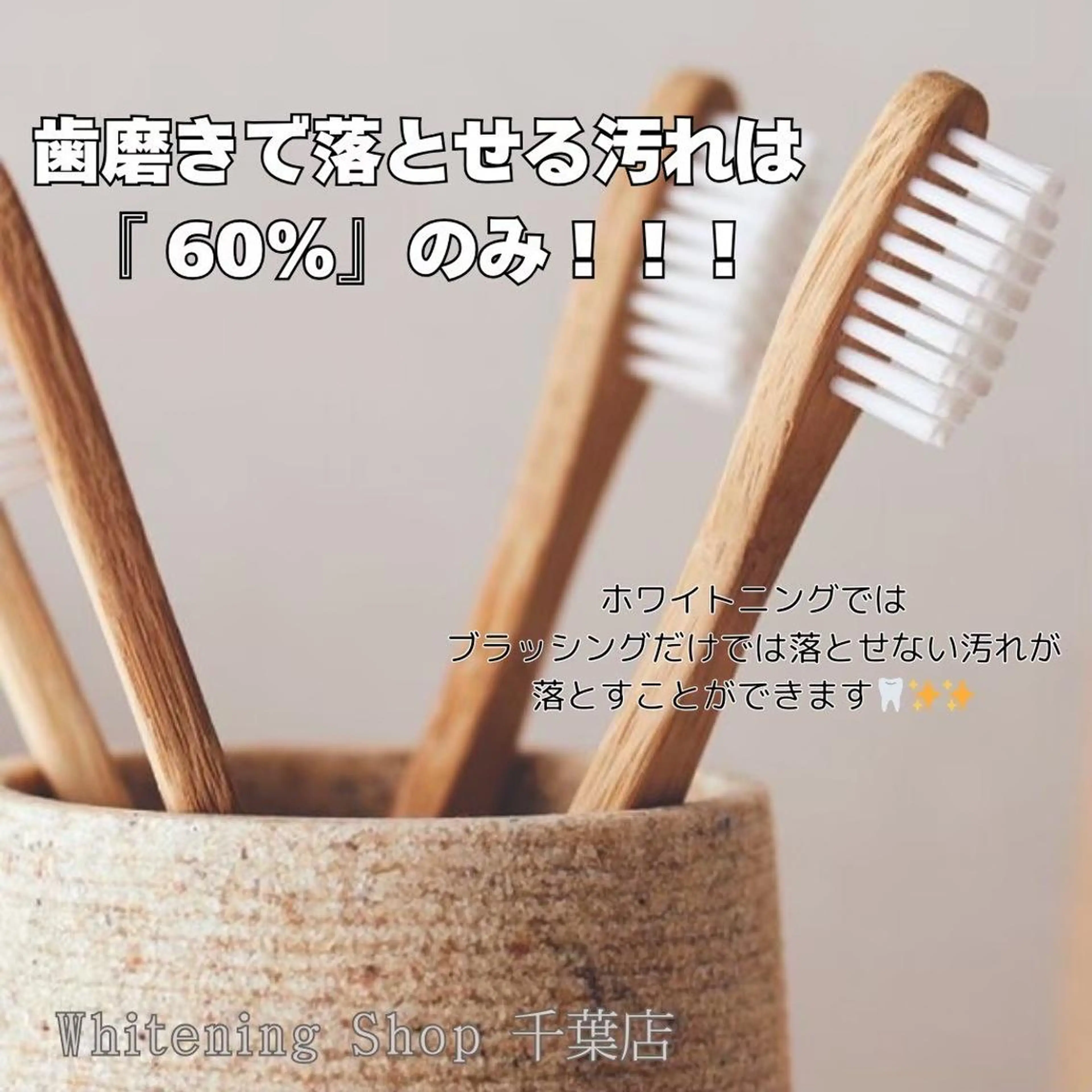 メンズ その他 ホワイトニング ショップ千葉店のその他イメージ