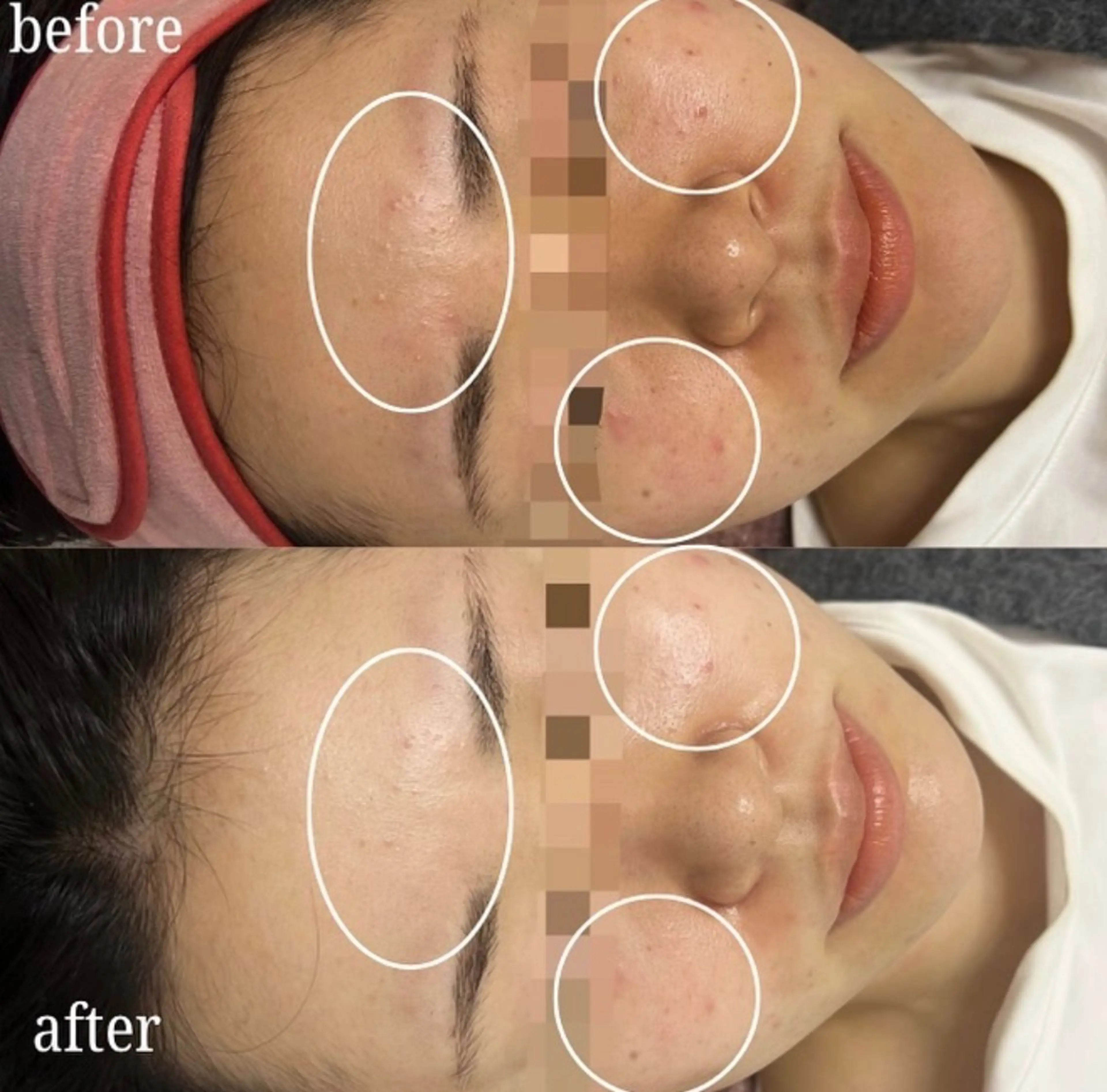 看護師が施術する美容 ナスサロ/城野のエステ・リラクイメージ