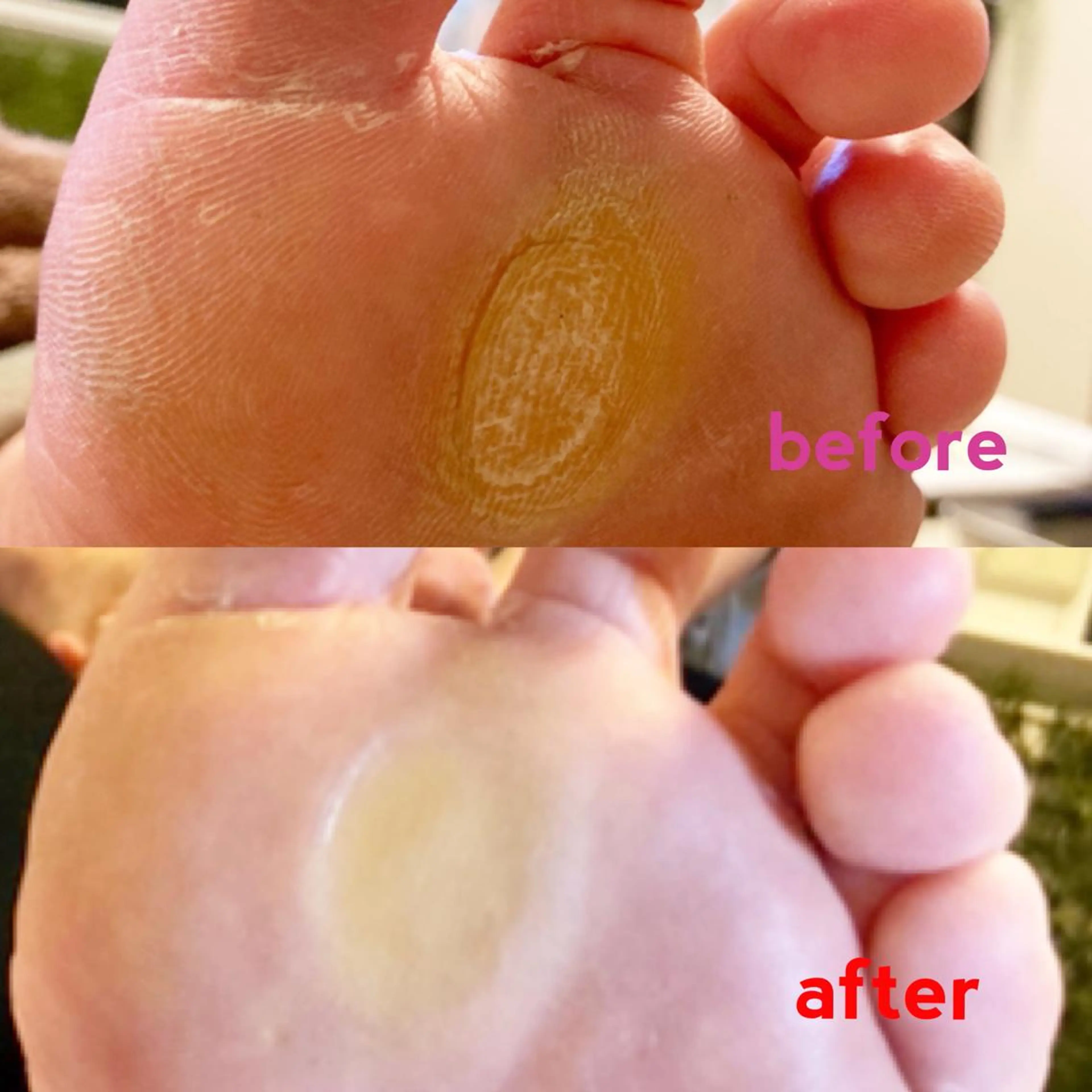 メンズ キッズ ネイル フットネイル その他 🌱 ま し お 🌱のその他イメージ