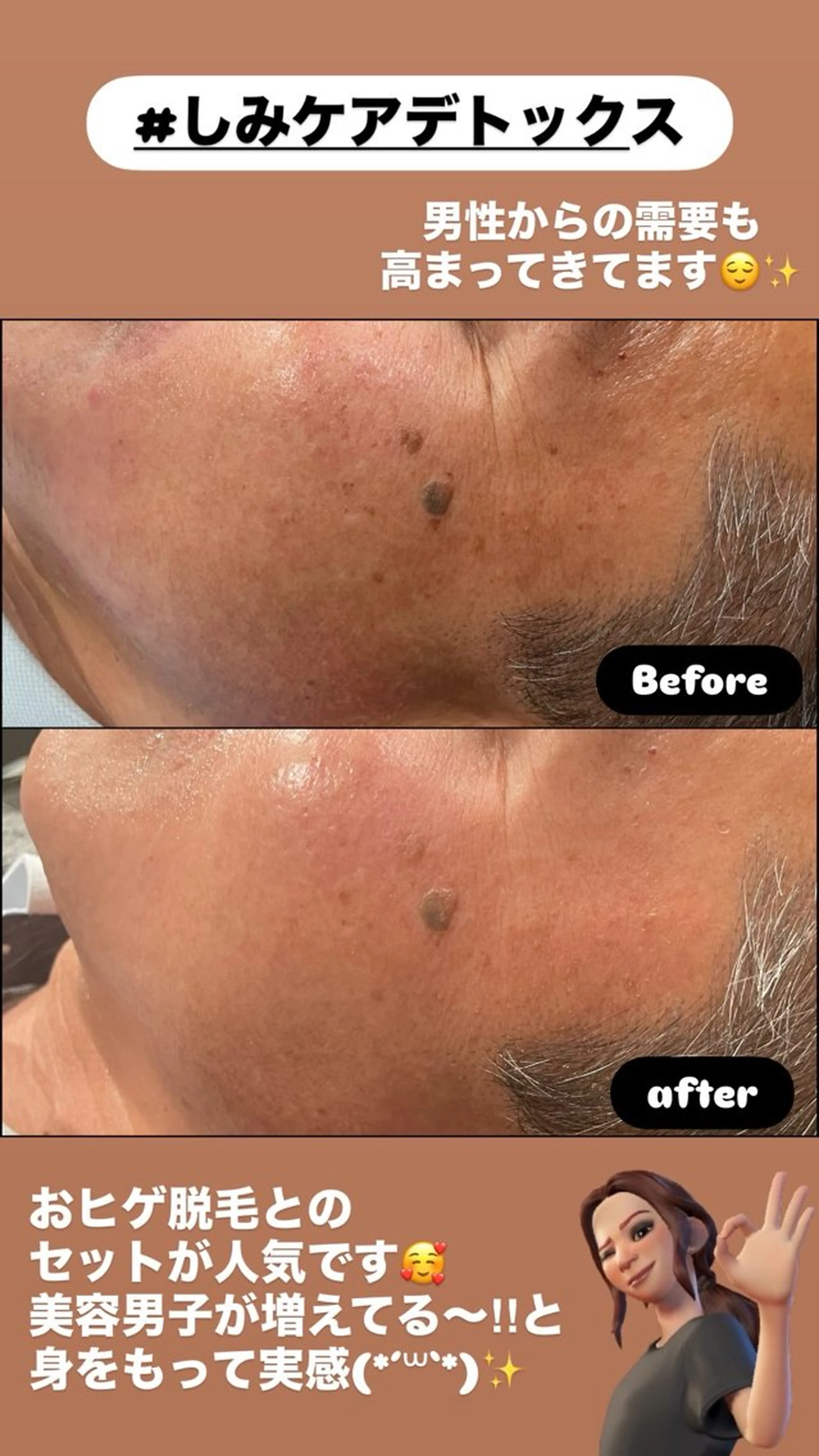 エステ LiZA エステティックサロンのエステ・リラクイメージ